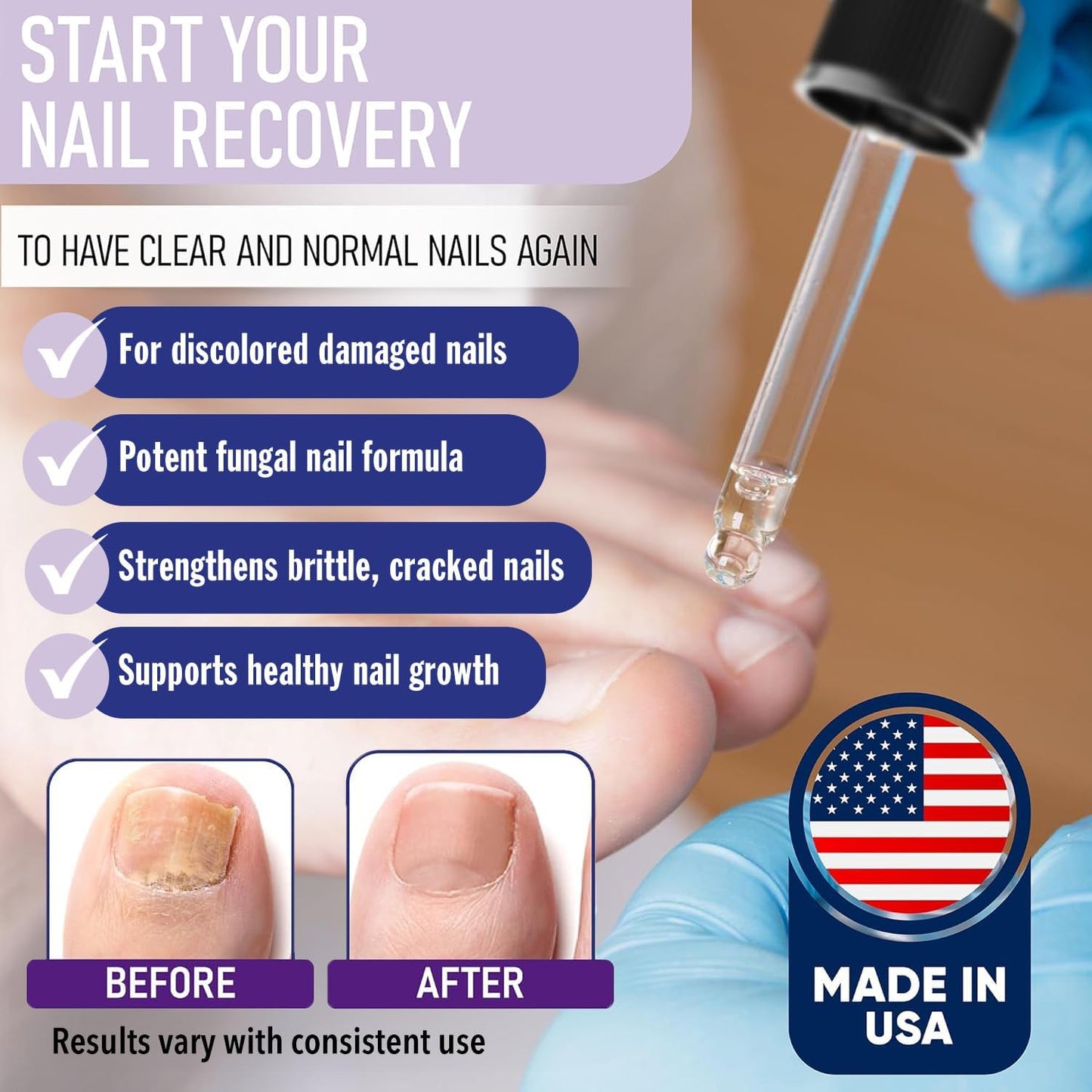 Nail Care Drops for Toenails & Fingernails - Daily Solution for Healthy Nails | Easy Application - 6-Pack