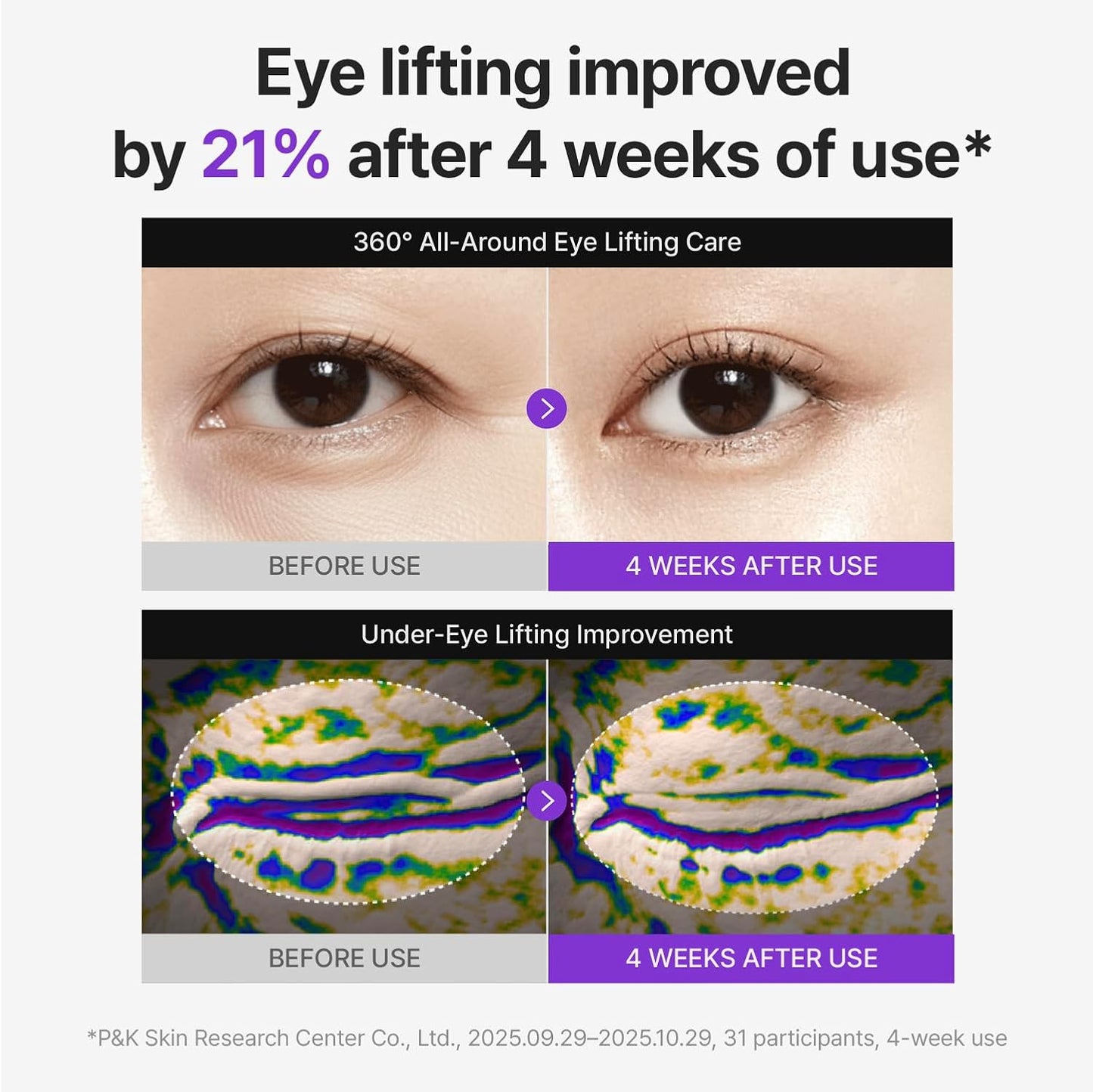Centellian 24 PDRN Eye Cream - Anti-Aging Retinol Treatment for Hooded Eyes | Hydrating, Firming, 1.01 fl oz