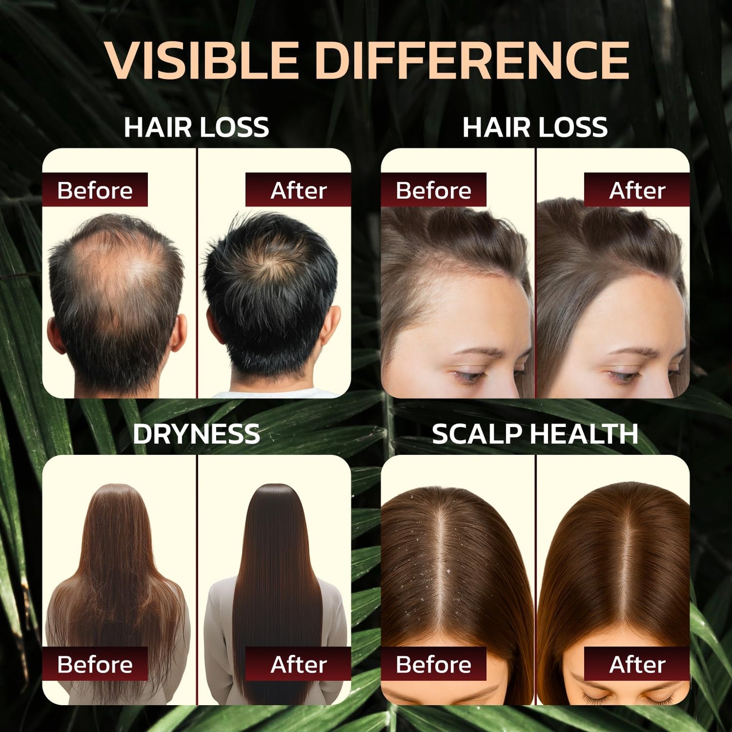Batana Oil for Hair Growth - 100% Pure & Unrefined - Raw Natural Dr. Sebi Botana Oil - Scalp Health, Strengthens, Thickens & Hydrates - Repairs Split Ends - Prevents Hair Loss for Men & Women