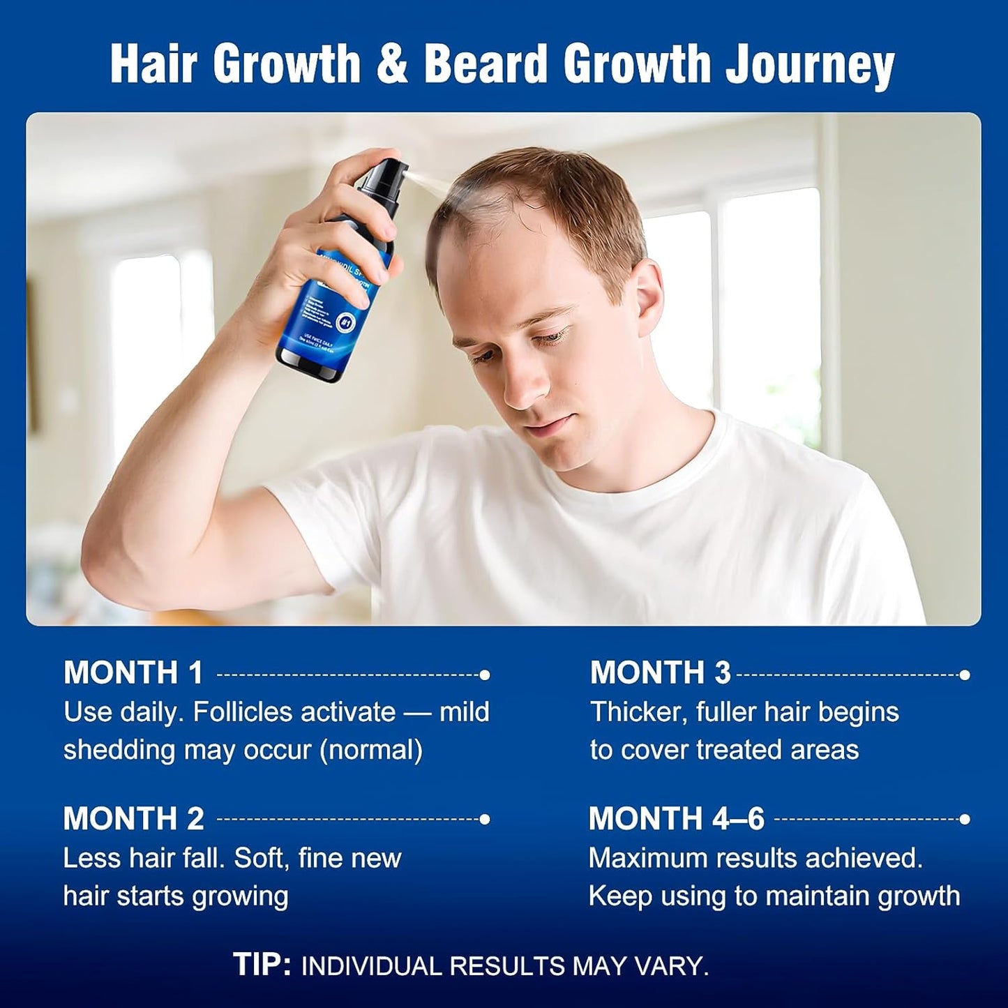 Minoxidil Hair Growth Spray for Men & Women - Biotin Infused Treatment | 6 Pcs, 12 Fl Oz Total