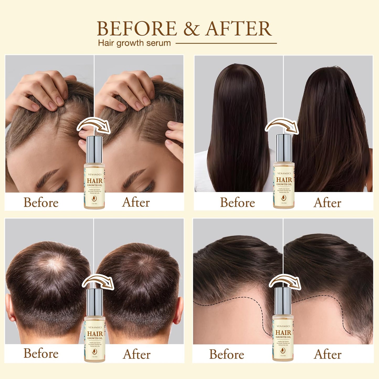Hair Growth Oil - Natural Rosemary & Biotin Serum for Thinning Hair | Promotes Thicker, Fuller Hair for All Hair Types