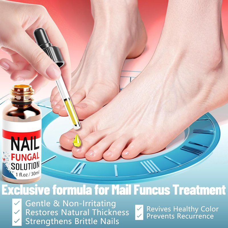 Toenail Fungus Treatment - Extra Strength 25% Undecylenic Acid | Gentle Plant-Based Formula, 1.01 Fl. Oz (Blue)