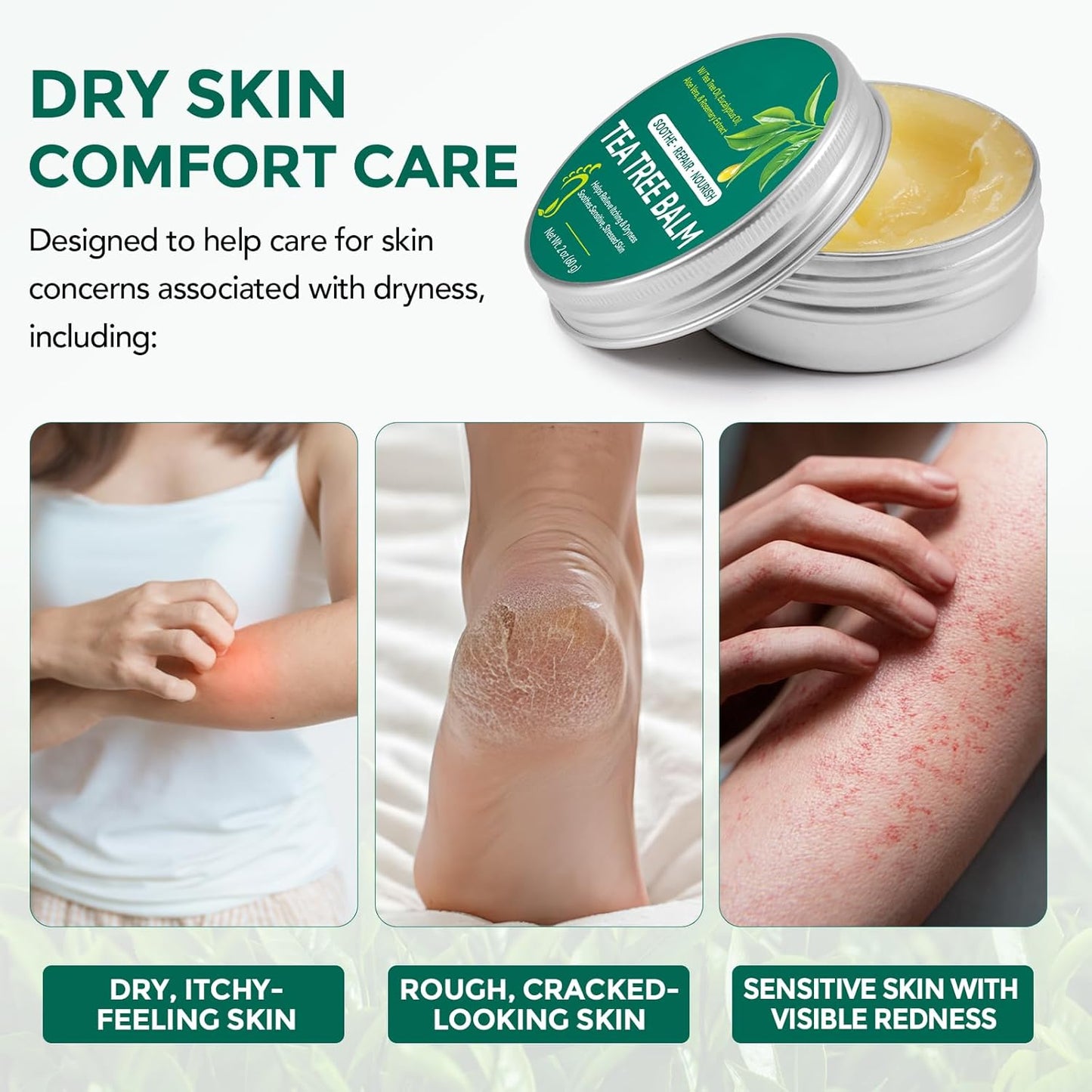 Tea Tree Oil Balm - Soothing Moisturizing Balm for Dry & Sensitive Skin | 2 oz, Natural Relief for Itchy Areas