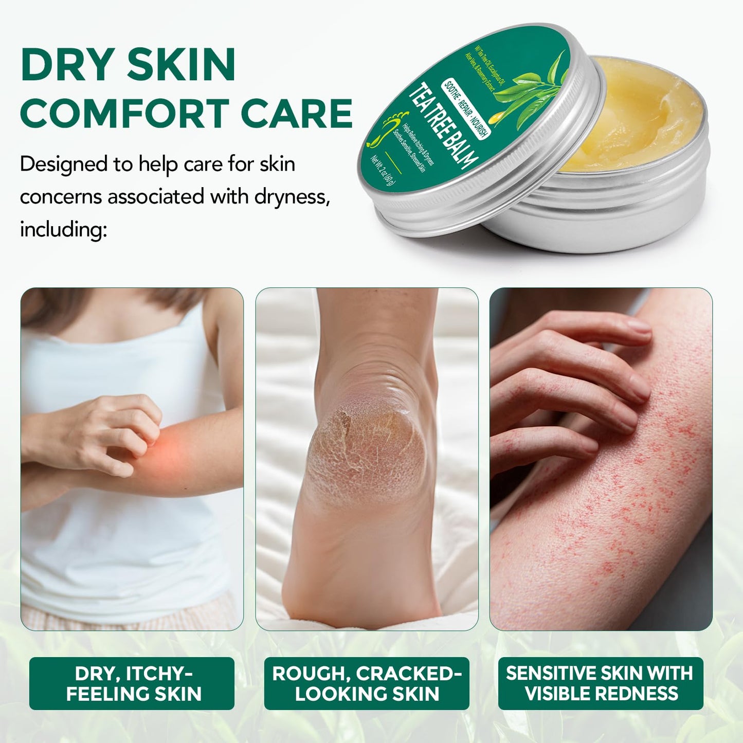 Tea Tree Balm for Dry Itchy Skin, Natural Tea Tree Oil Salve for Cracked Heels, Feet, Hands & Body, Moisturizing Herbal Skin Repair Balm with Aloe Vera, Eucalyptus, Green Tea & Vitamin E, 2 oz