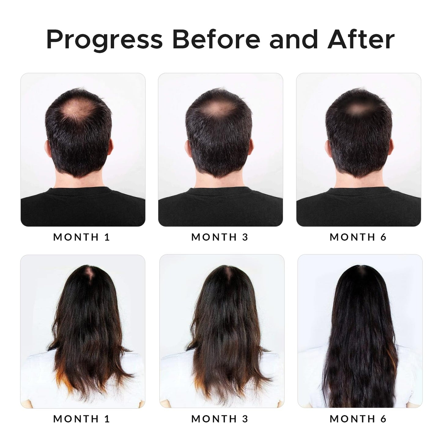 Twopack Thickening Hair Regrowth Shampoo for Thinning Hair - Enriched with Minoxidil, Biotin, Caffeine, Castor Oil & Onion - Supports Hair Growth and Strength for Men & Women - DHT Blocker Formula