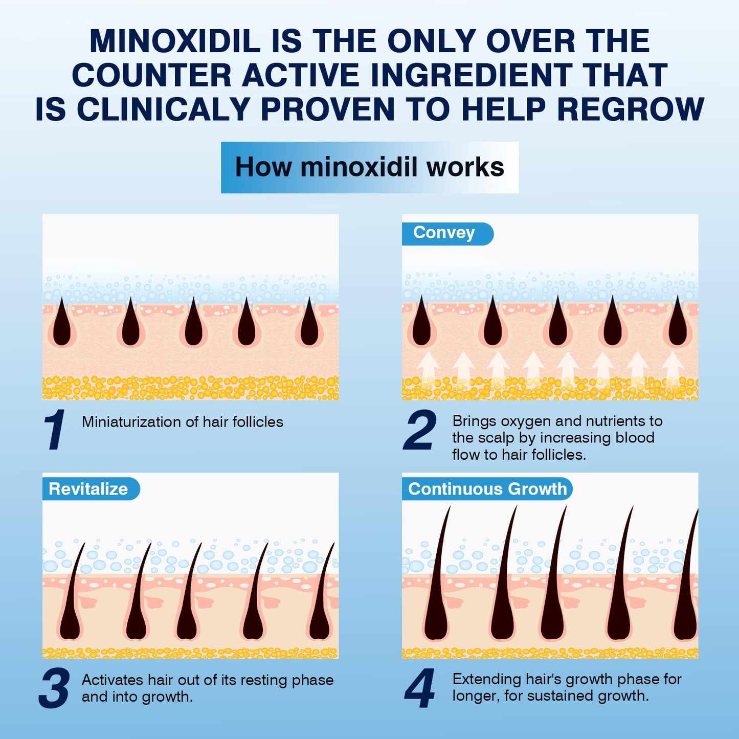 5% Minoxidil Foam– Hair Regrowth Treatment for Men & Women, Prevents Hair Thinning & Strengthens Roots, Minoxidil Foam for Fuller, Healthier Hair,9.52 Ounce (Pack of 1)