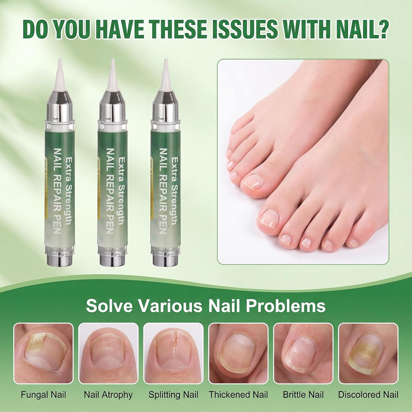 Nail Fungus Treatment Pen - 25% Undecylenic Acid Formula for Toenails & Fingernails | 16ml (3-Pack)