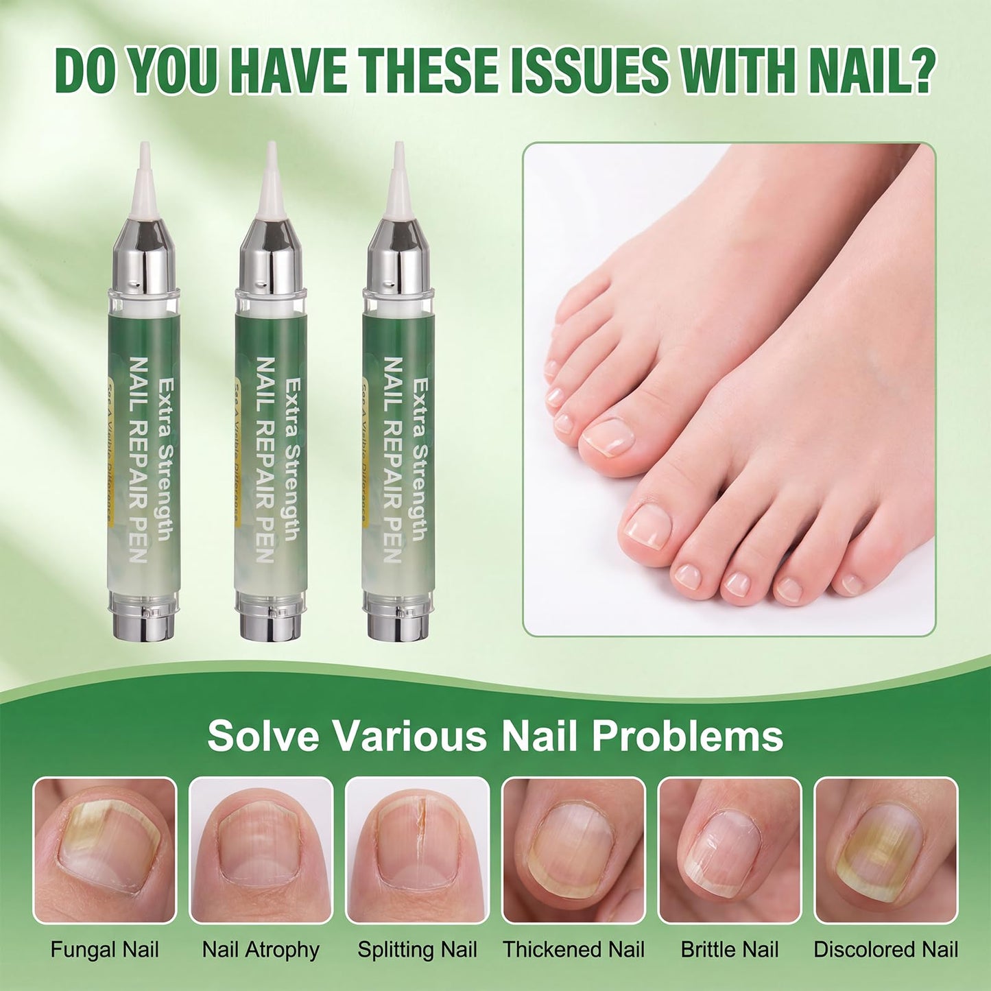 High capacity Nail Pen-16 ml per unit,Toenail Pen Treatment for Toenails & Fingernails, 25% Undecylenic Acid Formula （3-Pack Twist Pen ）