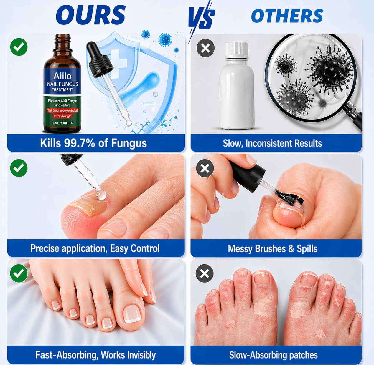 Nail Fungus Treatment - 25% Undecylenic Acid Liquid for Toenails & Fingernails | Extra Strength Nail Repair Solution, 2.02 Fl Oz