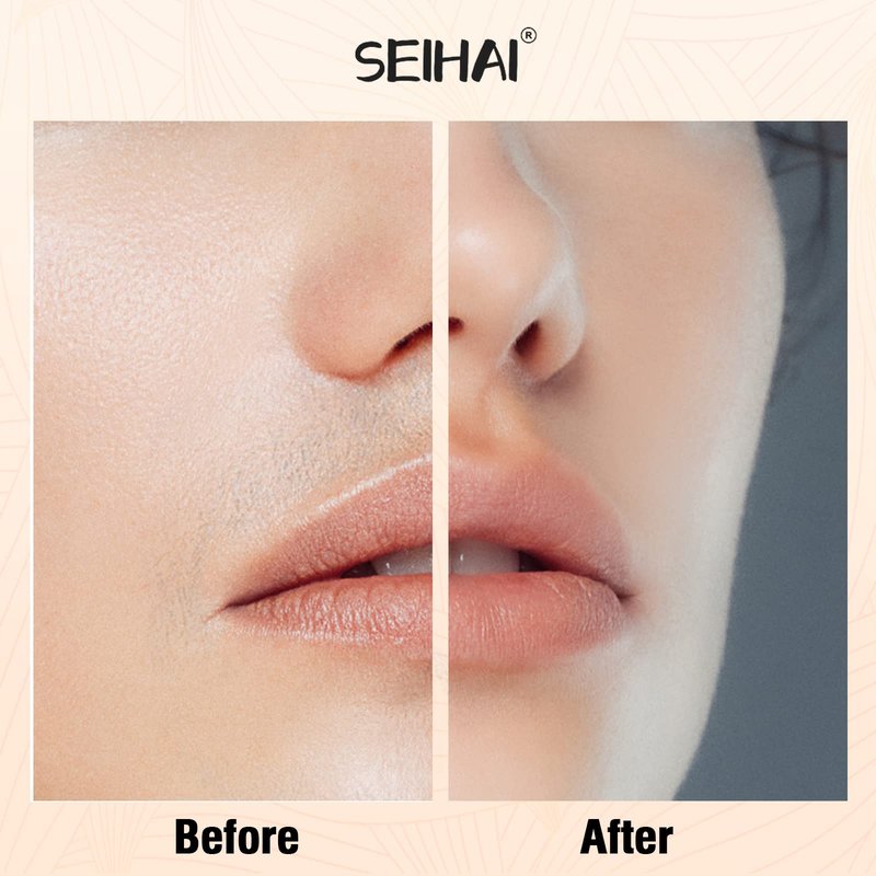 Facial Hair Removal for Women, Hair Removal Device, SEIHAI Rechargeable Hair Remover/face shavers, Facial Hair Remover for Upper Lip, Chin, Included 4 x Replacement Heads