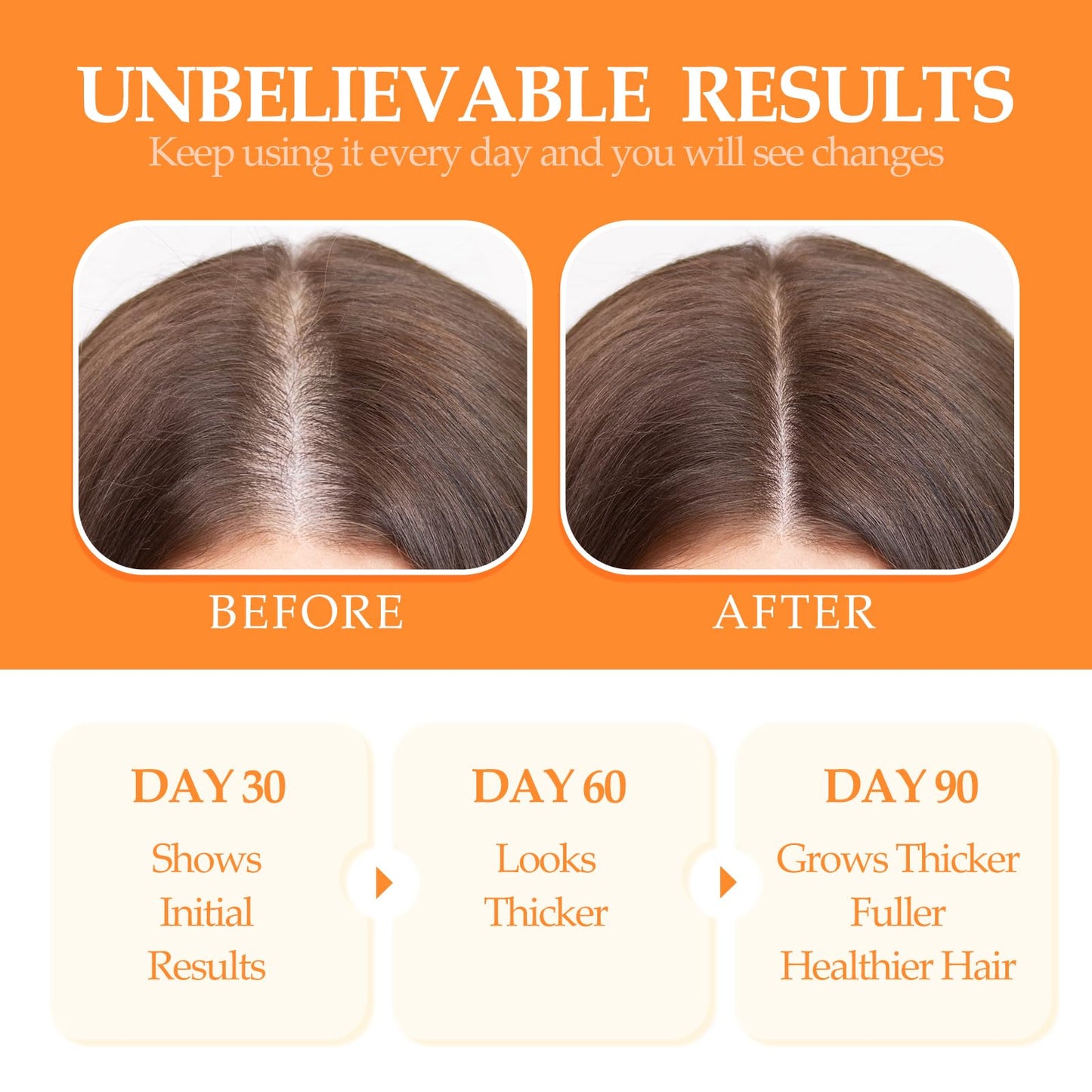 OLCG 100% Raw Batana Oil for Hair Growth - Pure Batana Oil Paste, Enhances Thickness & Shine, Reduces Breakage and Hair Loss, Nourishment For All Types - 4.06 fl oz（120ml）