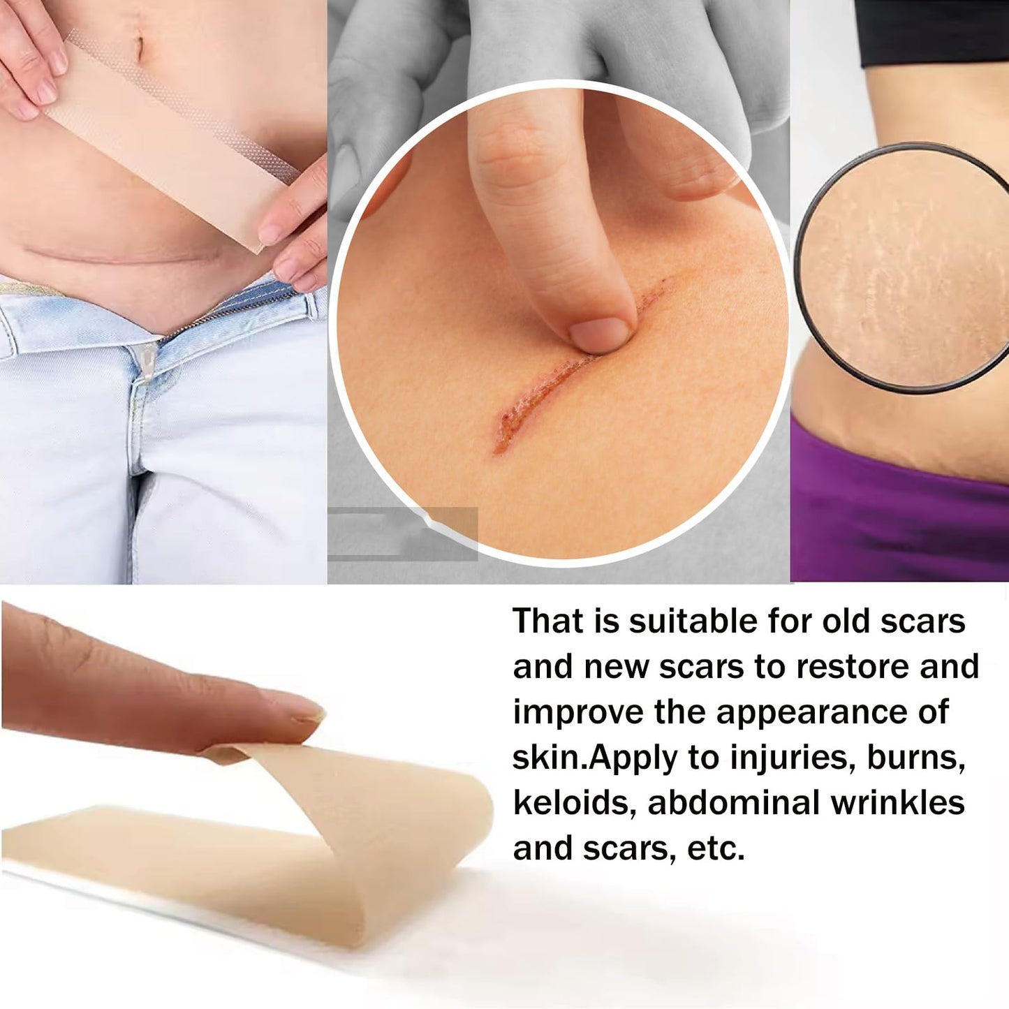 Silicone Scar Sheets(10 Pack),LXIANGN Medical Grade Silicone Strips (1.5" x 6") Professional Scar Removal Sheets Surgical Skin Care