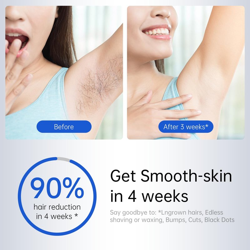 Wniopst IPL Hair Removal Device Gift for Women and Men, with Ice-Cooling Technology, Gentle Hair Reduction for Nearly, Hair Removal Device for Armpits Legs Arms Bikini Line, Corded