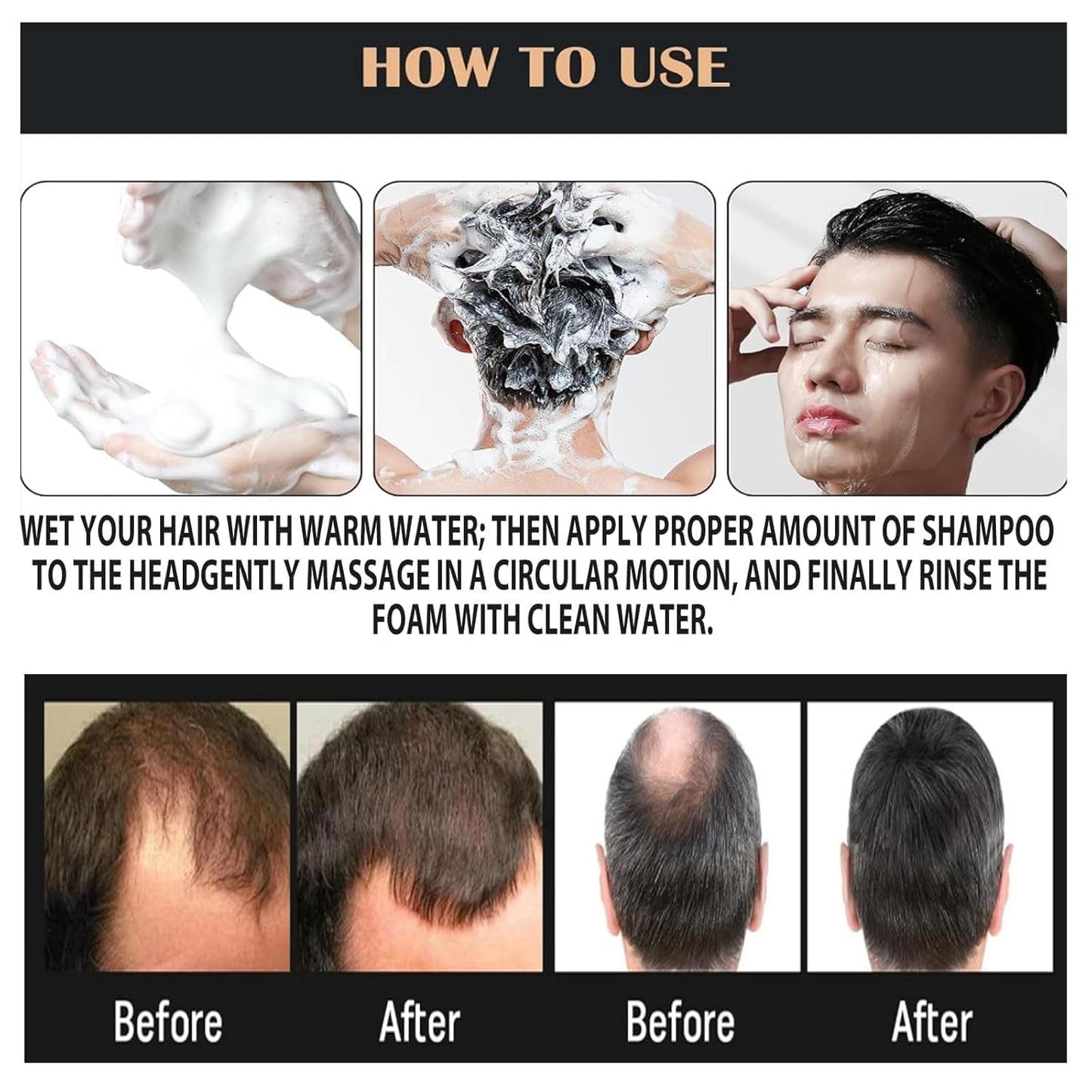 Spar𝓉𝒶𝓃ˢ Root Activator Shampoo– Anti Hair Loss Treatment | Reduces Shedding, With Natural Regrowth Formula | Thickening & Nourishing For All Hair| Reduce Shedding,Smooths Hair, 1PCS