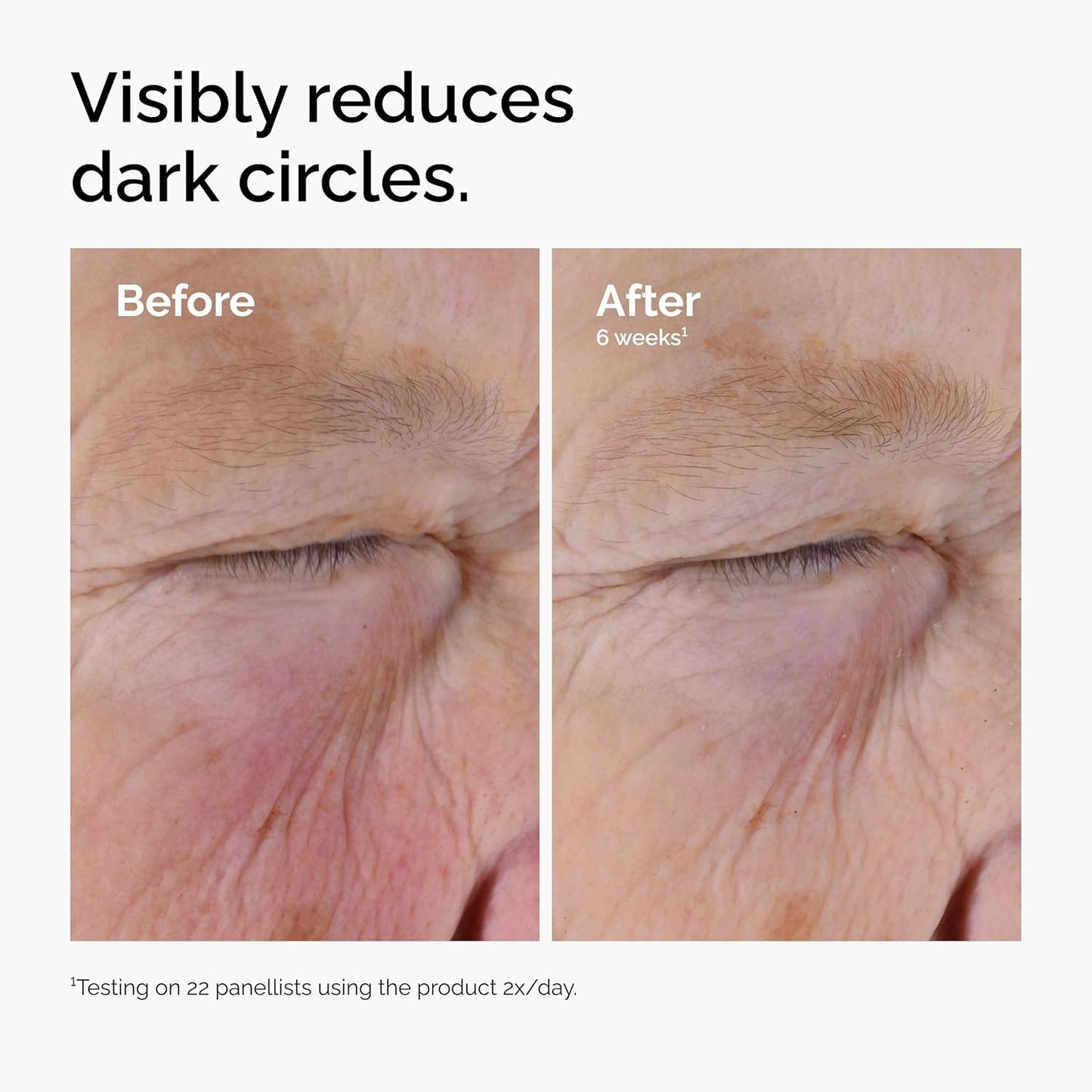 Caffeine Eye Serum - The Ordinary 5% + EGCG Depuffing Formula for Dark Circles | Brightening & Refreshing 30ml