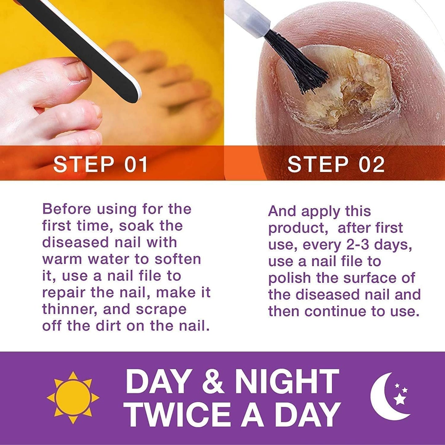 Toenail Fungus Treatment Kit - Extra Strength Fungal Nail Renewal with 25% Undecylenic Acid | 1 Oz Nail Repair Liquid & File