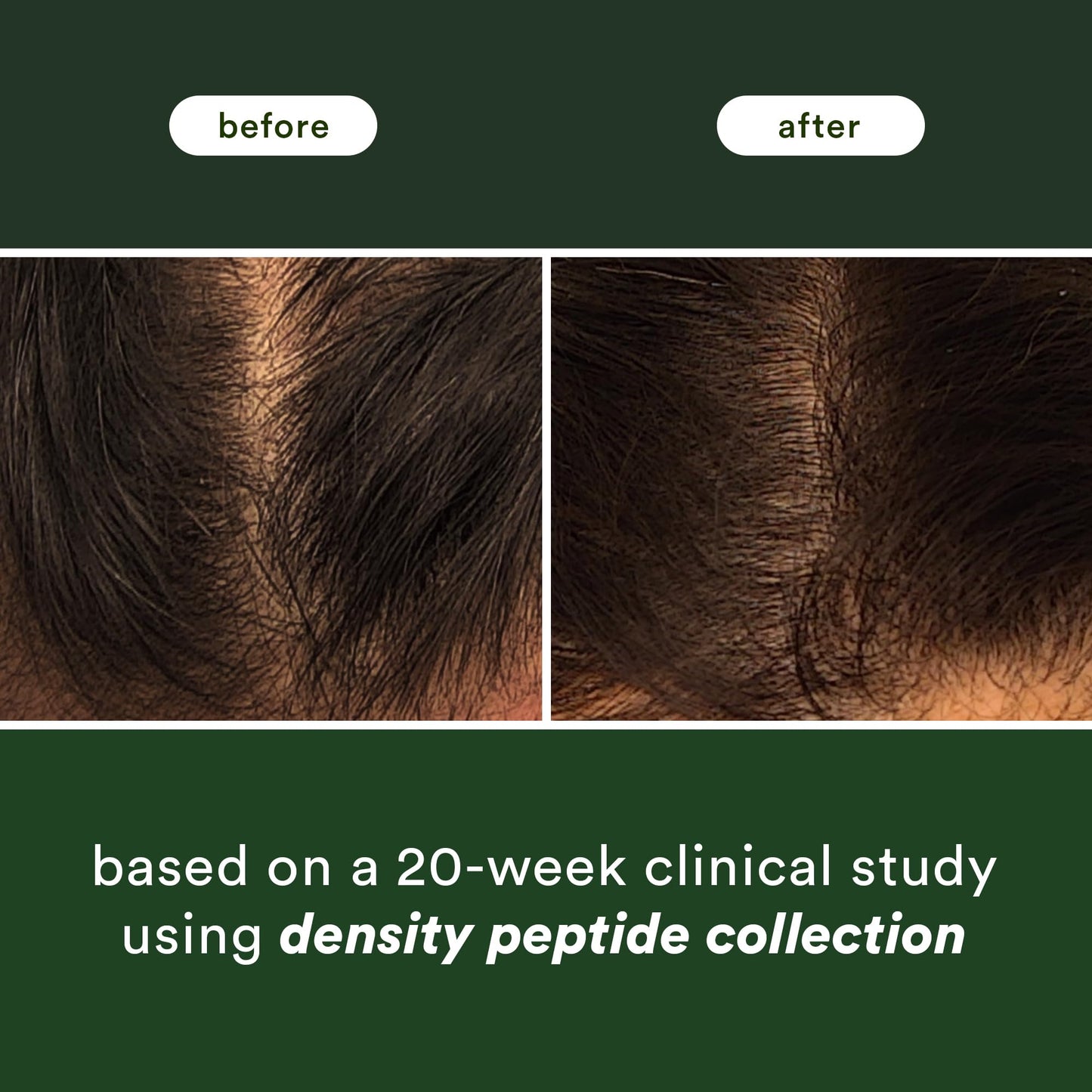 VERB Density Peptide Serum, 1 fl oz - Visibly Thicken + Reduce Signs of Shedding- No Parabens or Harmful Sulfates
