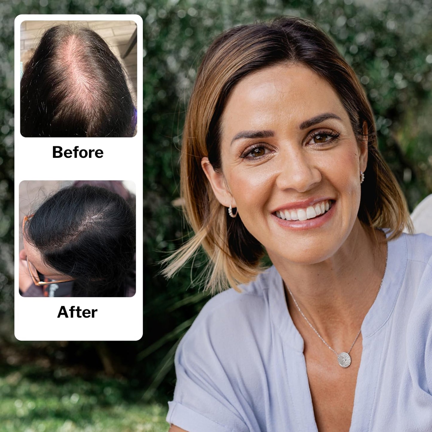 Shapiro MD Women's Hair Regrowth Kit - Shampoo, Conditioner & 2% Minoxidil | Anti-Hair Loss Solution, 1 Month Supply
