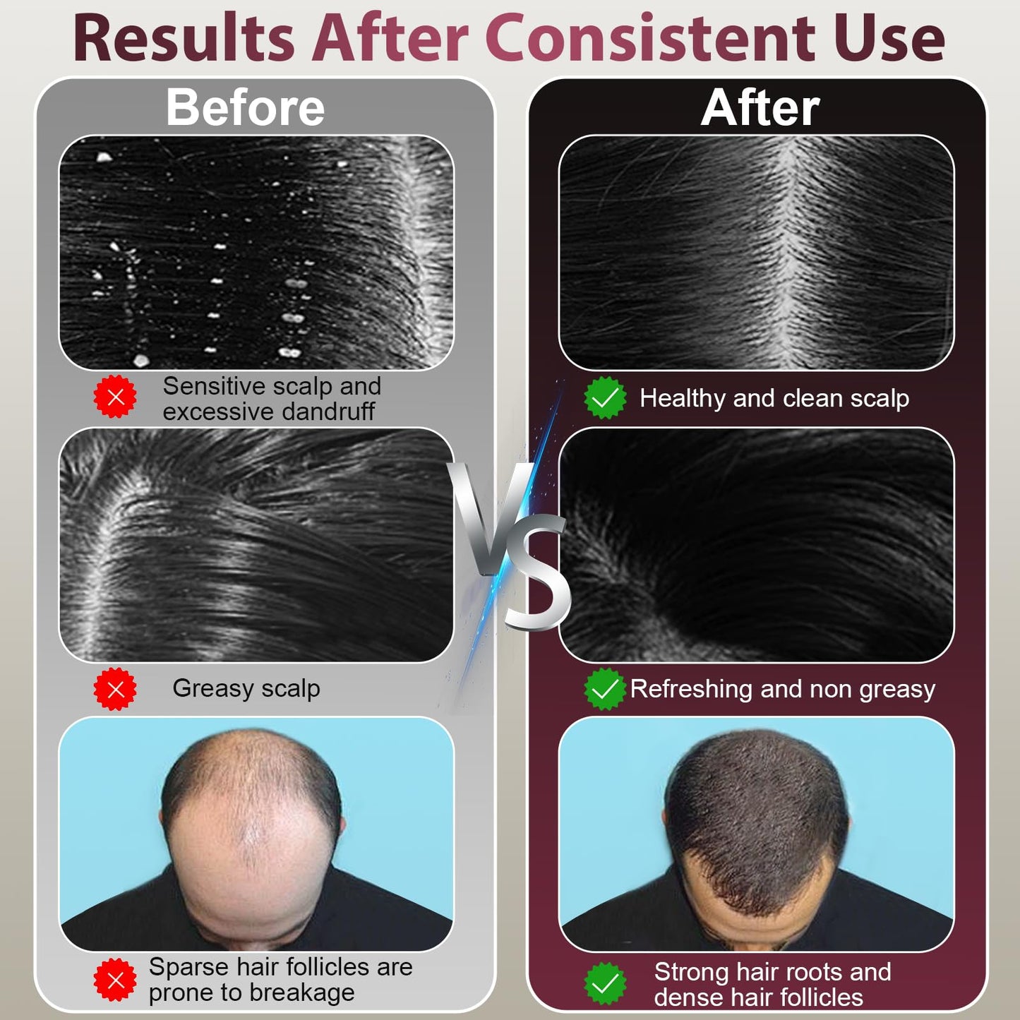 CWTUL Laser Therapy Hair Growth Comb, Hair Oil Applicator,Electric Scalp Massager Hair Growth with IPX7 Waterproof