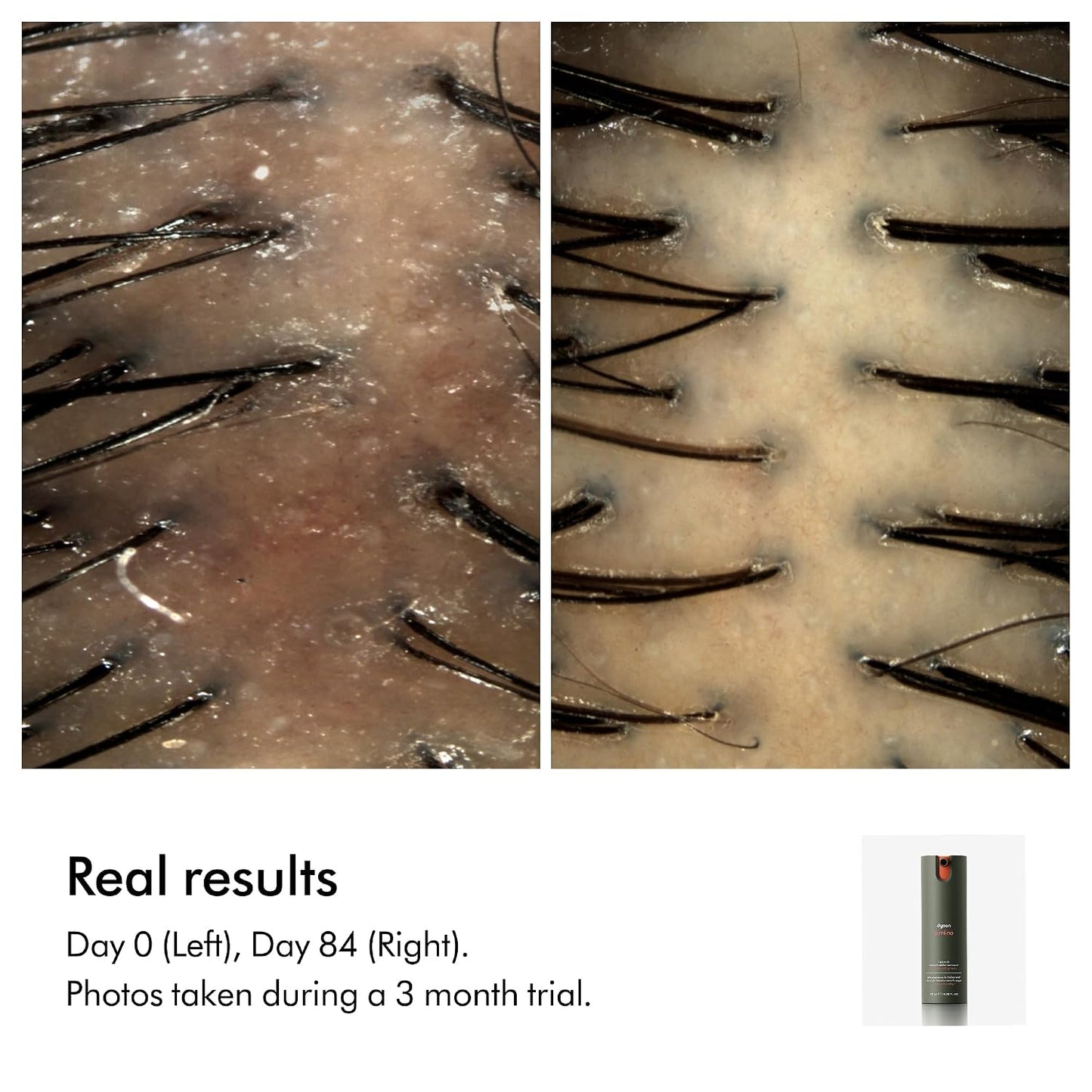 Dyson Amino™ Leave-In Scalp Bubble Treatment - Nourishing Hair Care Solution