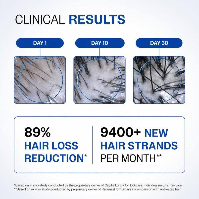 Hair Growth Serum - 3% Redensyl, 4% Anagain, Biotin & Rosemary | Hair Fall Control & Strengthening Formula