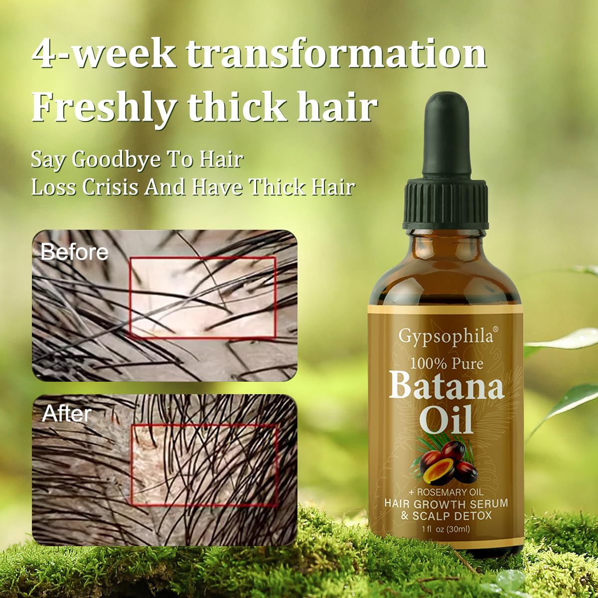 Gypsophila Batana Oil for Hair Growth -100% Pure Natural Hair Growth Oil,Nourishes The Scalp, Eliminates Split Ends, Reduce Hair Loss & Detox Your Scalp (1 Fl Oz) for All Hair Types