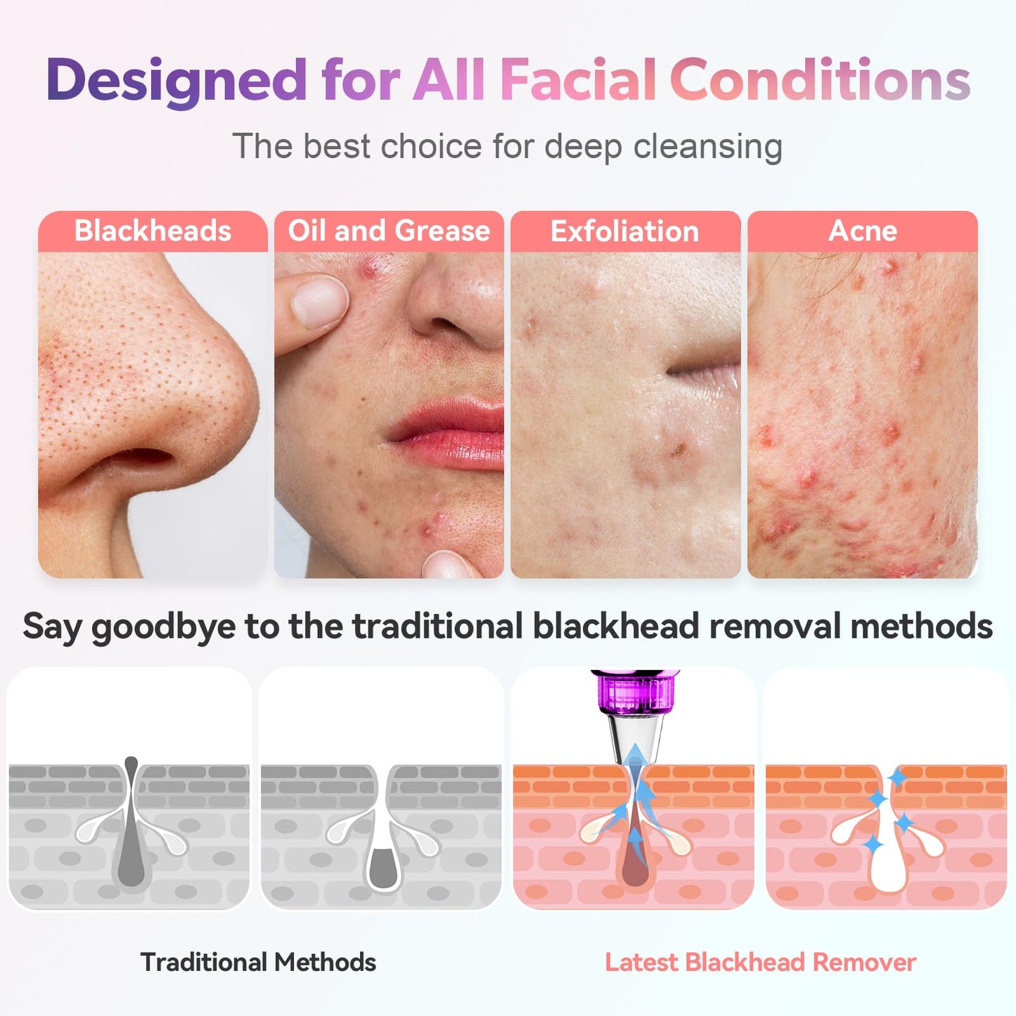 Blackhead Remover Vacuum, Blackhead Vacuum, Facial