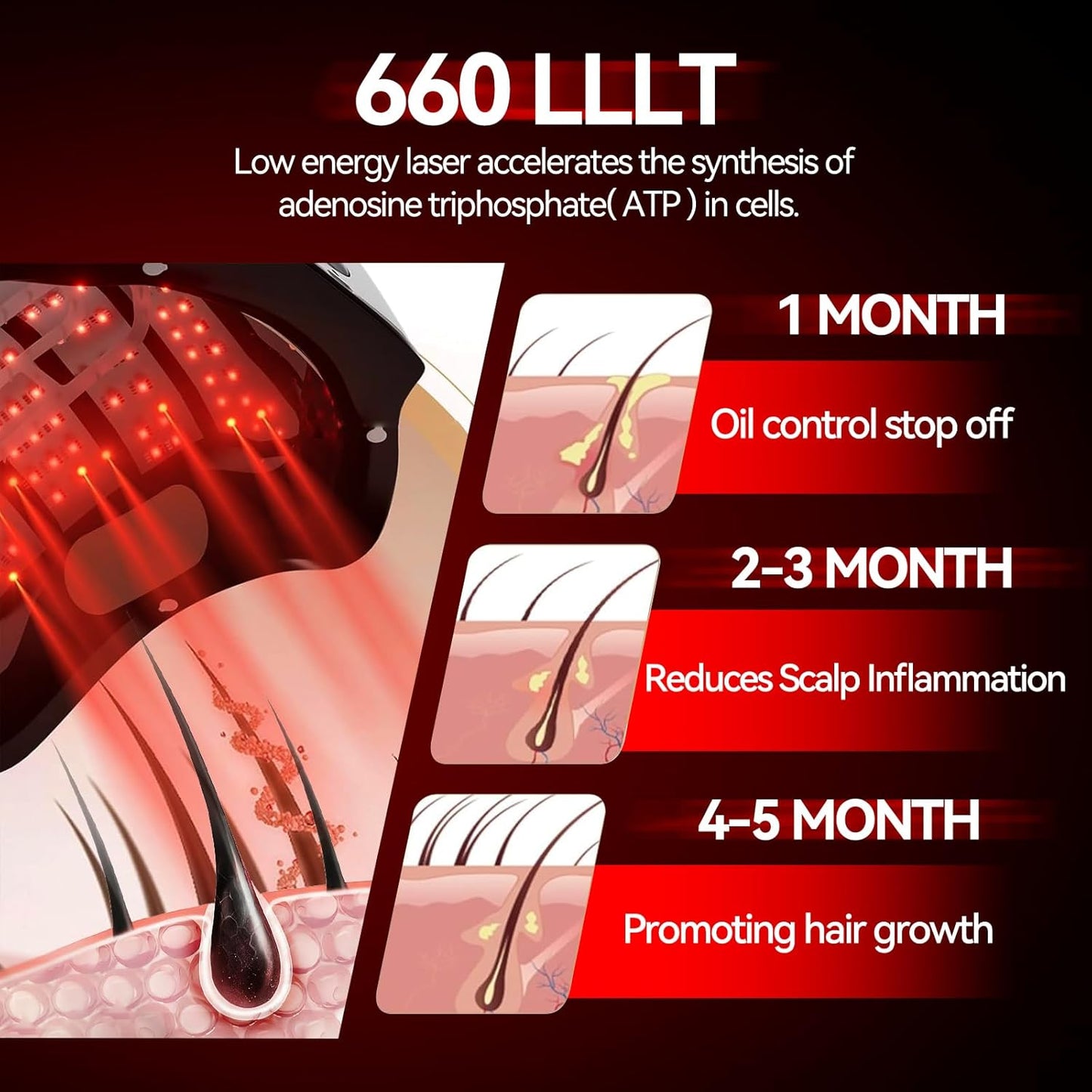 Laser Cap Hair Growth Device - FDA Cleared Red Light Therapy for Thinning Hair | Effective Alopecia Treatment for Men & Women