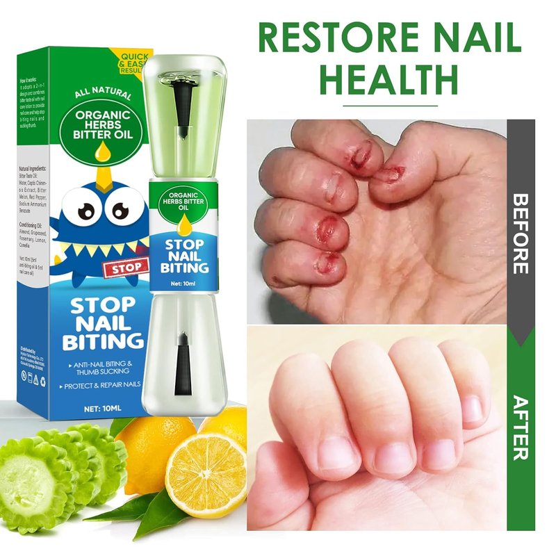 Nail Biting Treatment for Kids & Adults - 2-in-1 Prevention Solution | Discourages Biting & Thumb Sucking, 0.34 Fl Oz