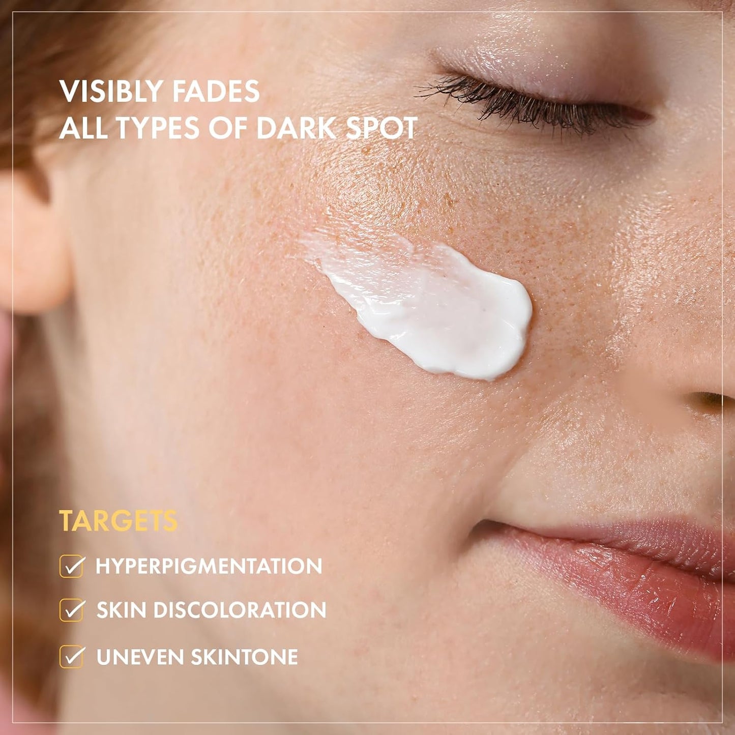 TOSOWOONG Dark Spot Remover Cream - Advanced Niacinamide Formula for Face | 50g (1.76 oz)