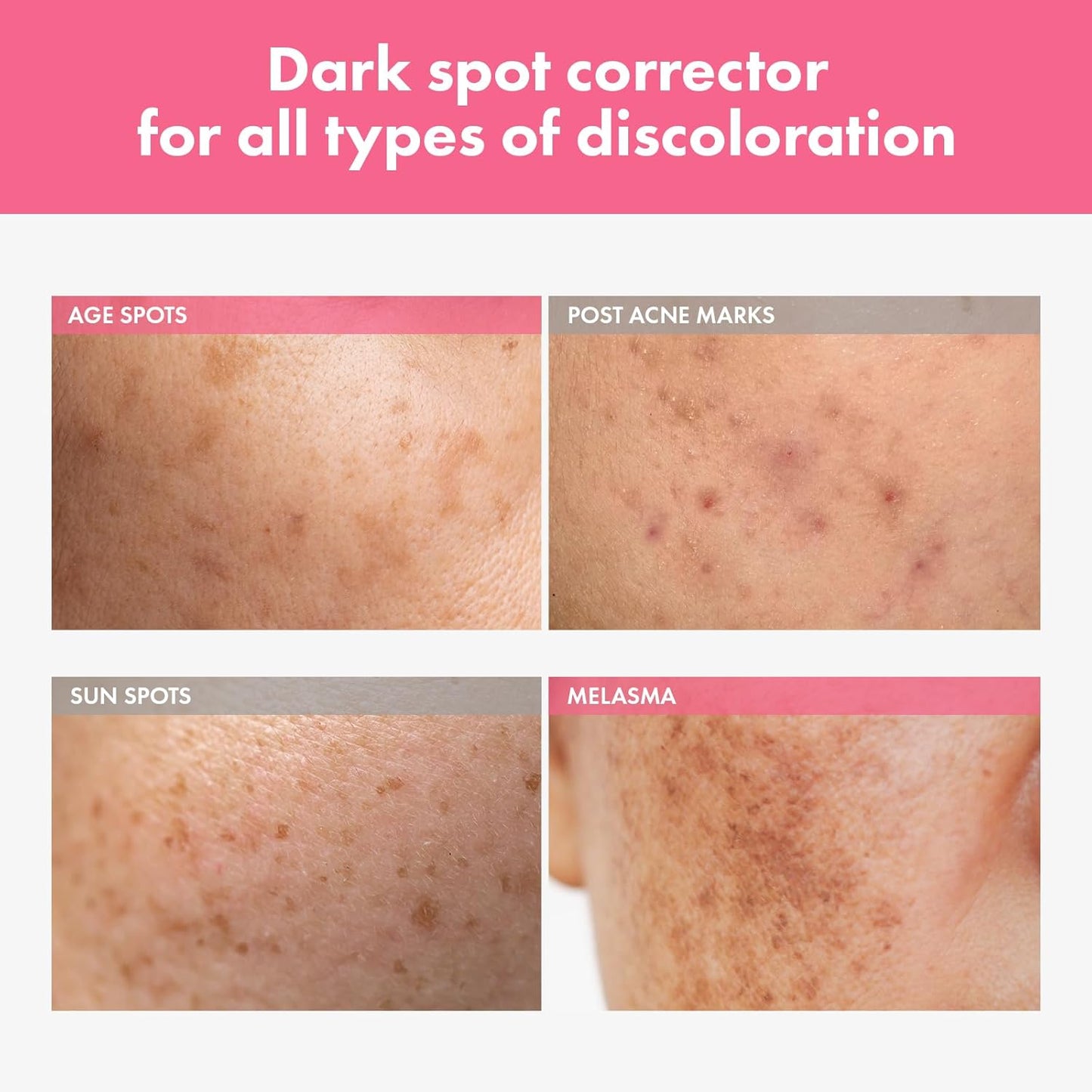 Arbutin 7% Intensive Spot Cream - Dark Spot Treatment with Tranexamic Acid & Niacinamide | 20ml