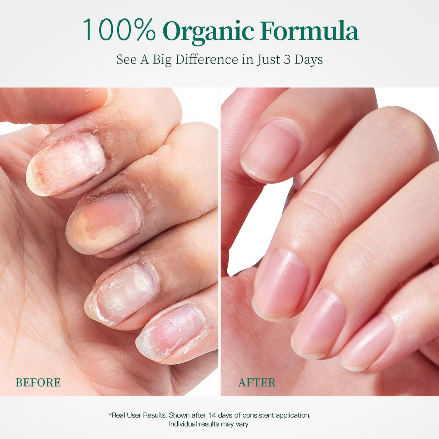 Apuree 100% Bio-Based Cuticle Oil: Nail Strengthener Growth Oil 1oz| Deep Moisture for Extra Dry Cuticles for Brittle Peel Breaking Thin Nails| Black Rose Extract| USDA Verified| Daily Nail Care|Vegan