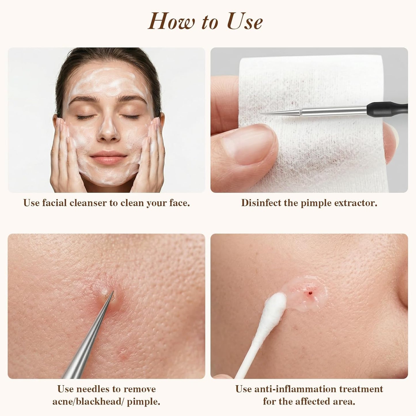 Pimple Extractor Tool Kit - 6 Stainless Steel Blackhead Remover Tools with Leather Case