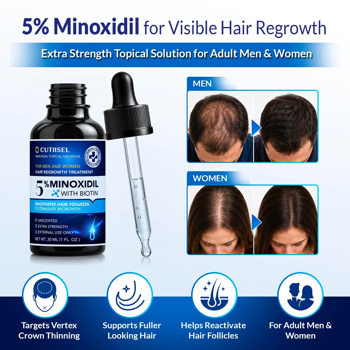 Minoxidil for Men and Women Extra Strength: Minoxidil 5% Topical Solution for Hair Regrowth Treatment for Hair Loss & Thinning Hair - Liquid Formula with Dropper Applicator