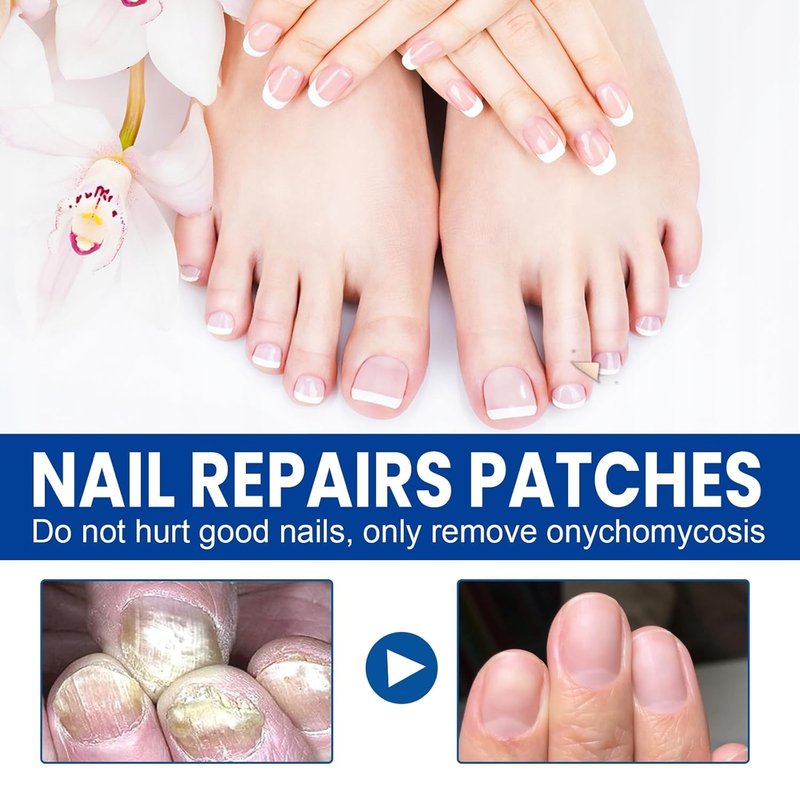 Toenail Fungus Treatment - Extra Strength Hydrogel Nail Repair Patches | 60 Pcs for Fast Renewal