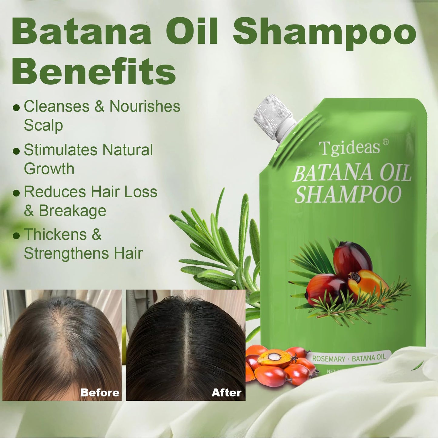 Tgideas Batana Oil Rosemary Shampoo for Hair Growth & Hair Loss, 1 Pack