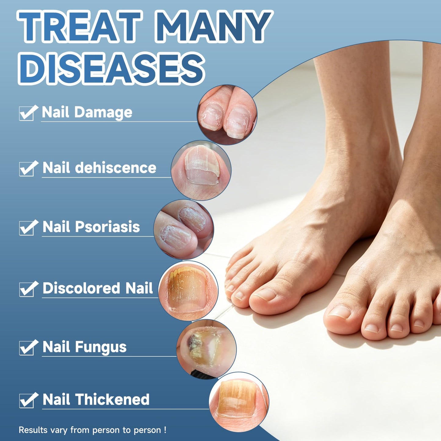 BeamBalm Maximum Strength Nail Fungi Treatment