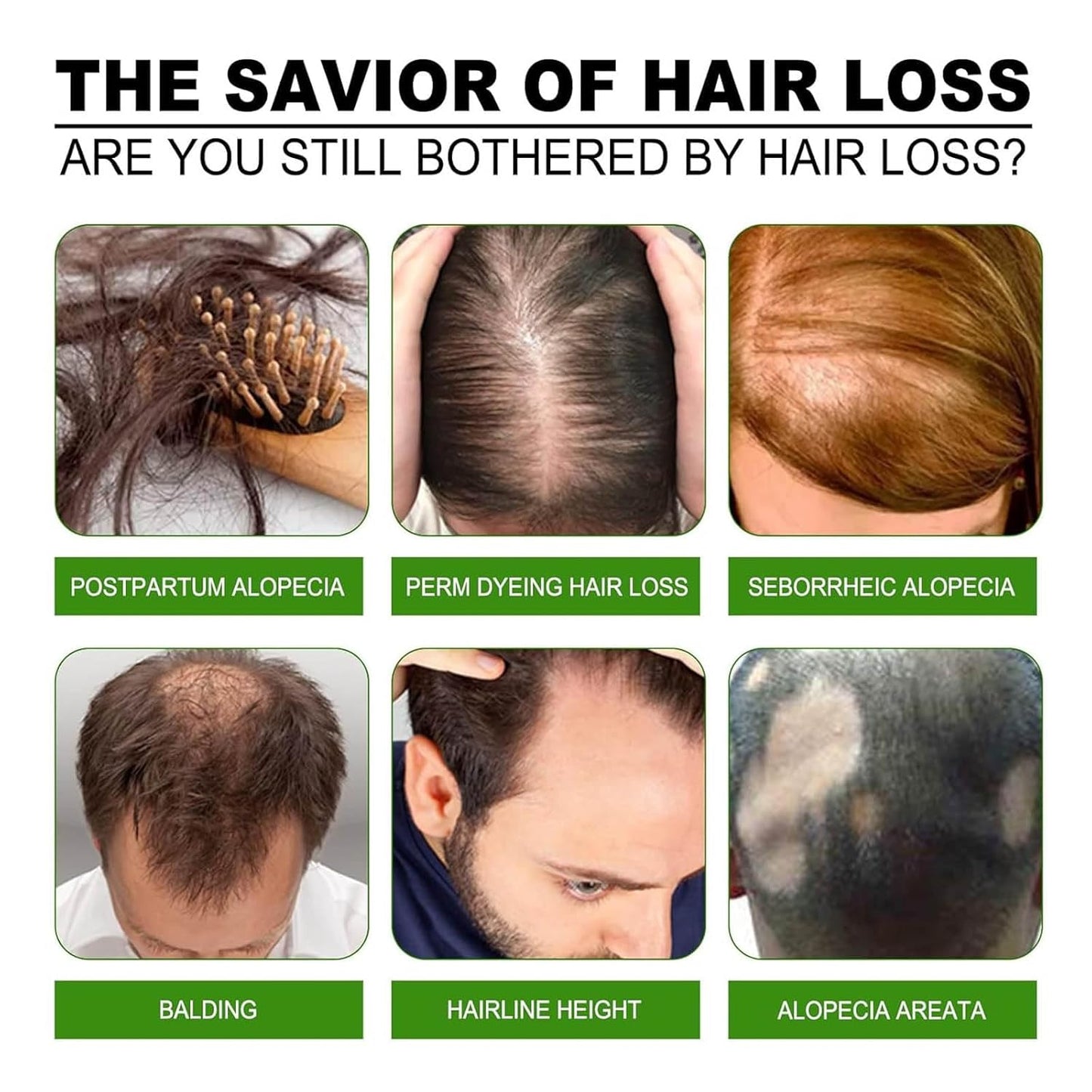 Advanced Hair Regrowth System - Ginseng & Peppermint Oil Treatment for Thicker Hair | Unisex Serum (1)