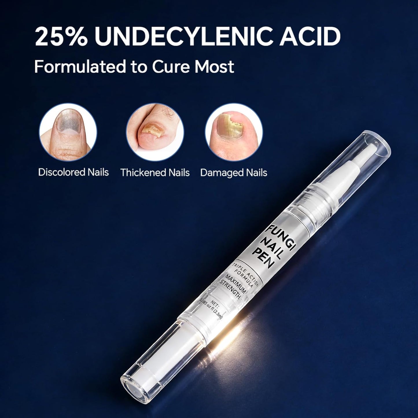 Toenail Fungus Treatment Pen - 25% Undecylenic Acid for Thick, Discolored Nails | 4 Pack