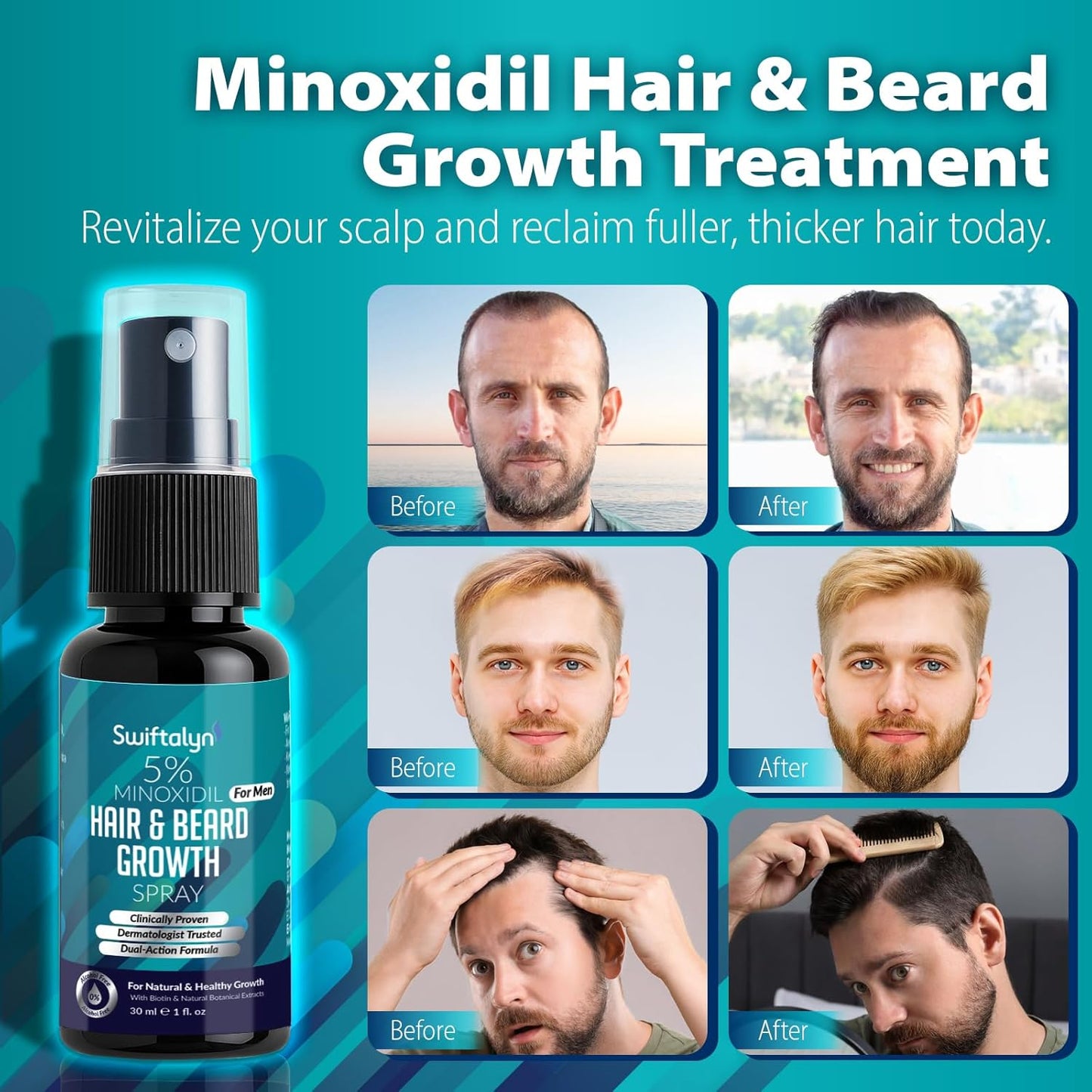 Minoxidil Hair Growth Oil for Men - Beard & Hair Spray with Biotin, Ginger & Lavender Extracts | 5% Solution