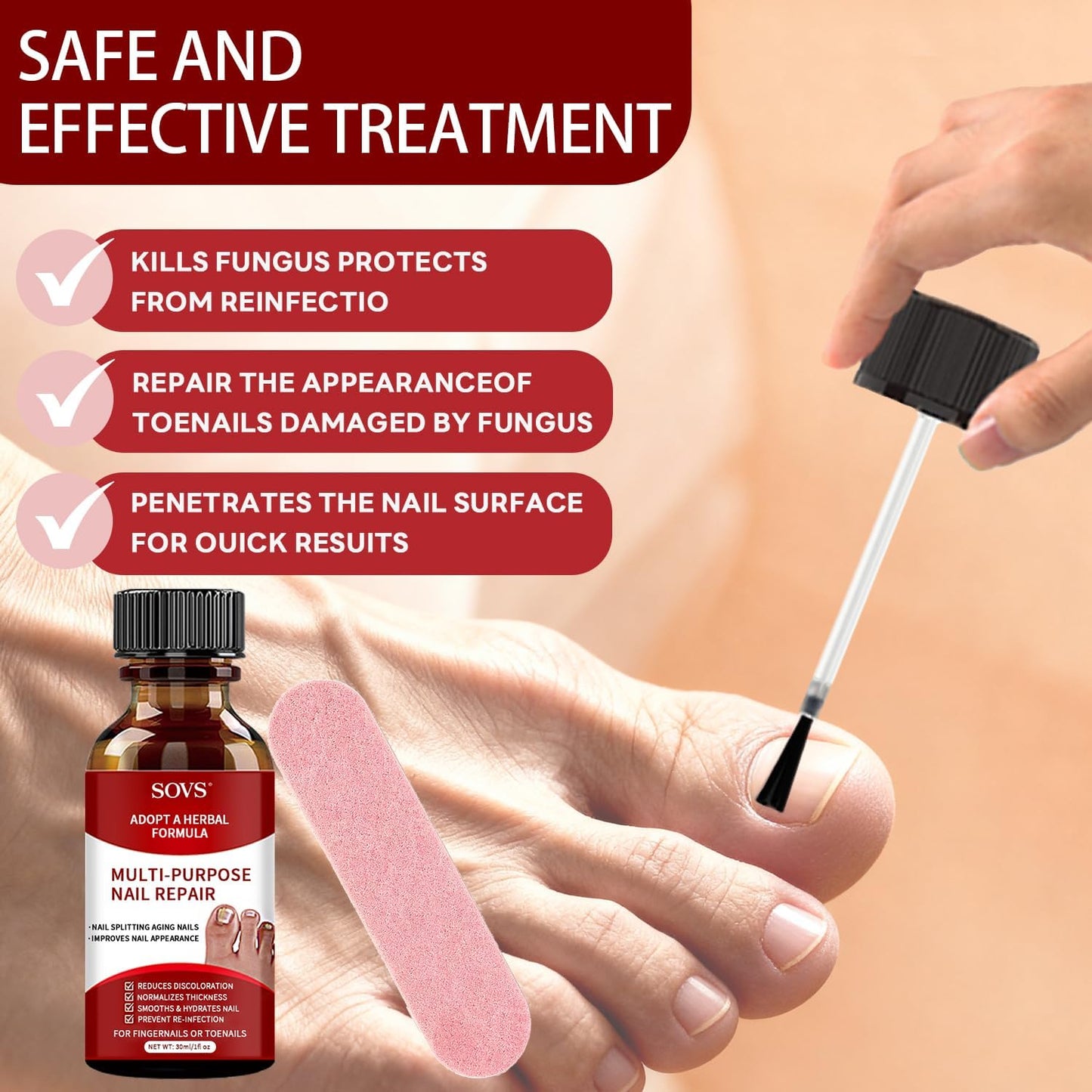 SOVS Toenail Treatment,Gentle Formula, Effectively Improves Nails for a More Beautiful Appearance（1pcs）