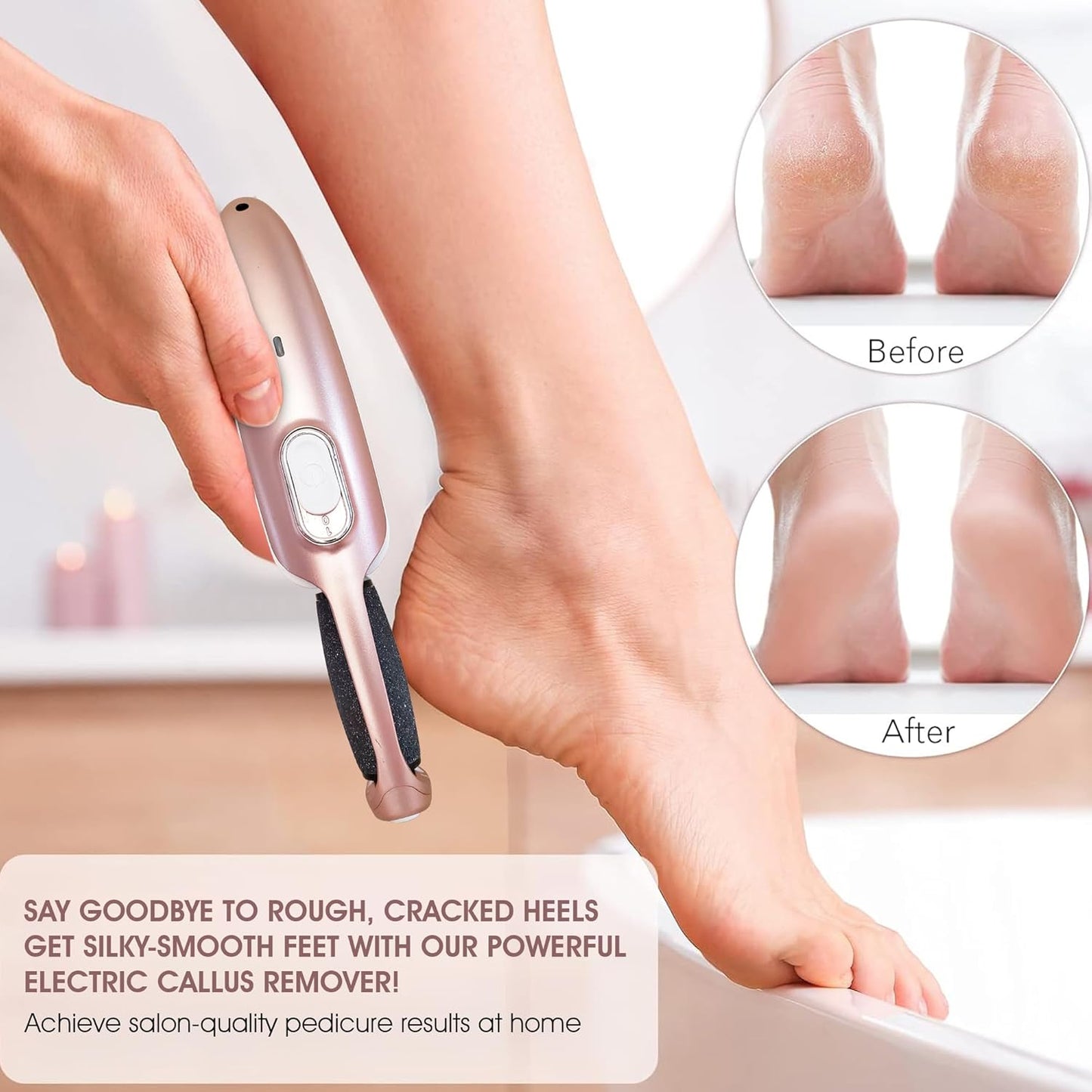 Electric Callus Remover Wand - Rechargeable Foot File & Scrubber for Soft, Smooth Feet | Rose Gold