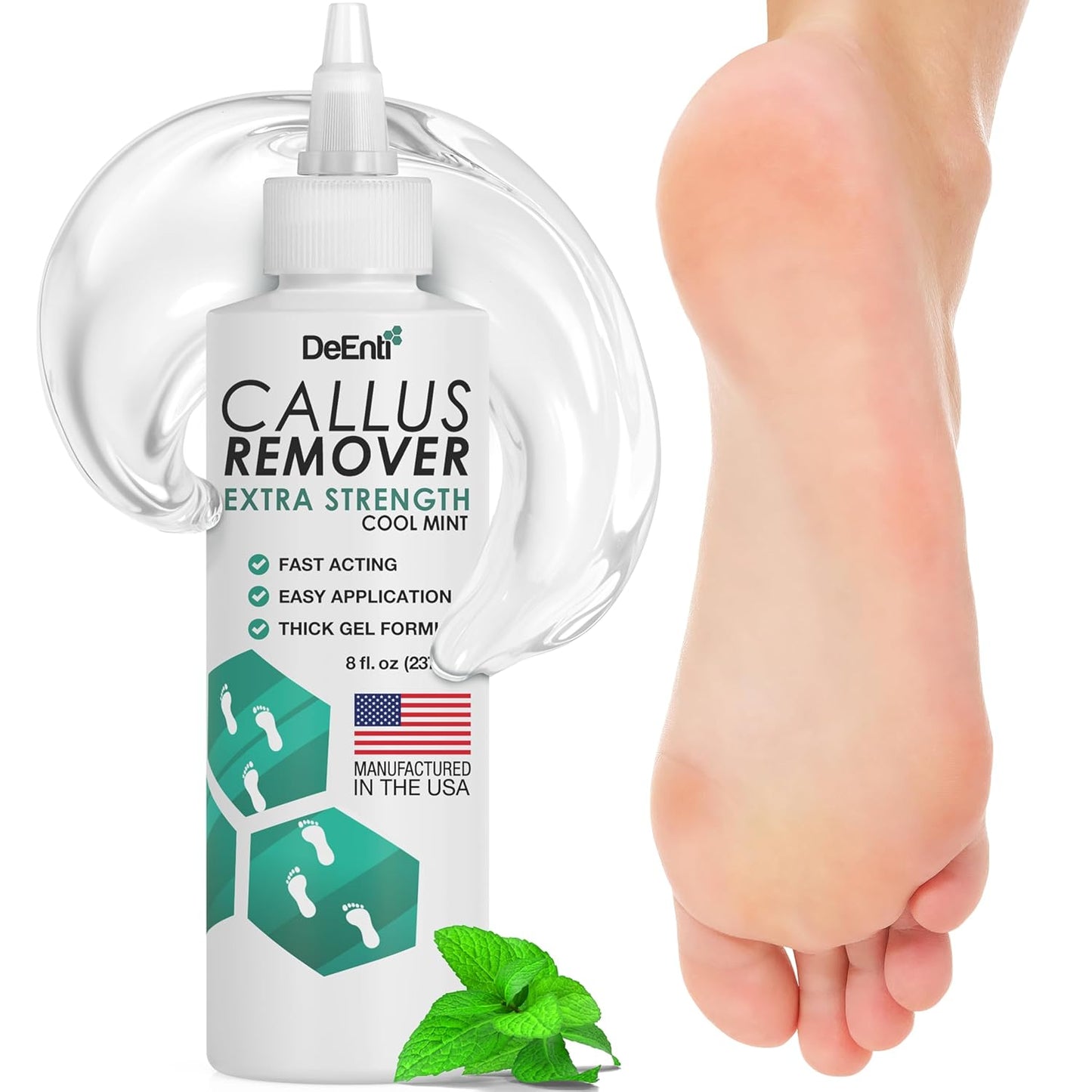 Callus Remover Gel for Feet - Extra Strength 8oz | Professional Pedicure Supplies for Dry Skin & Cracked Heels