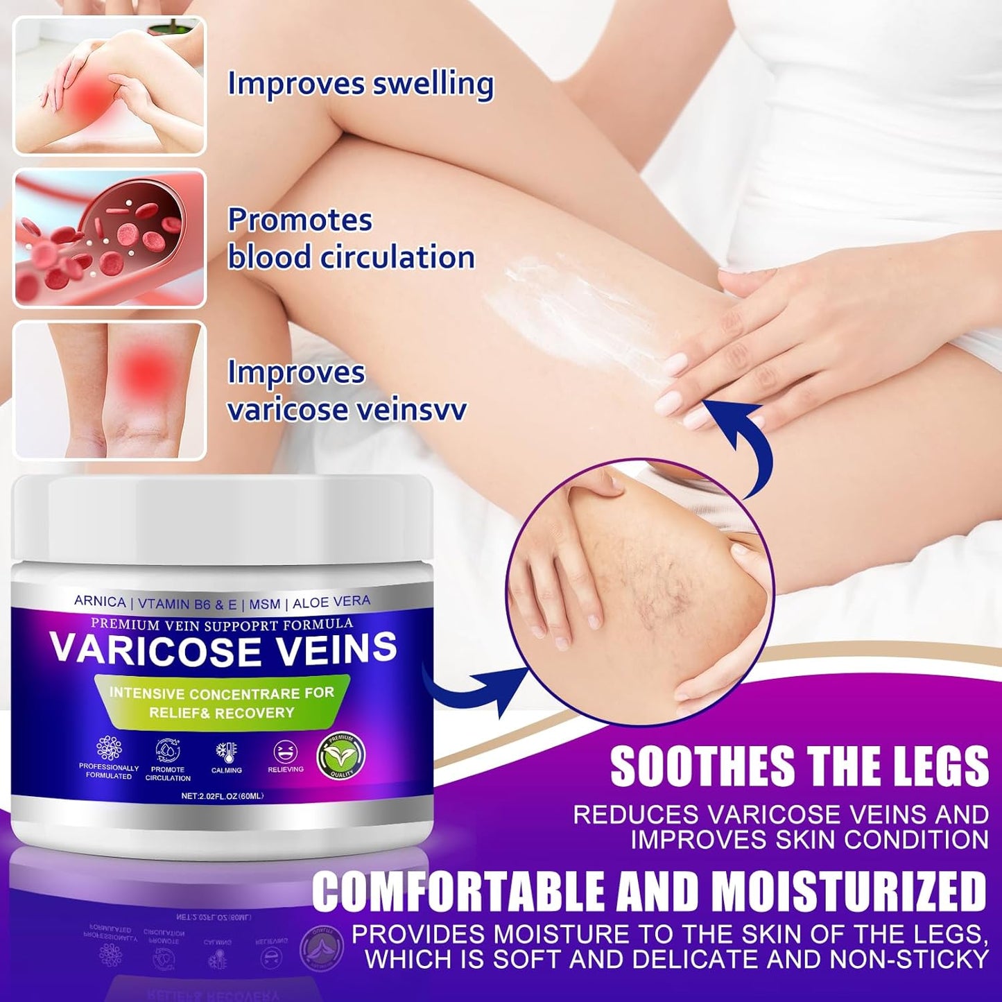 Varicose Veins Cream - Spider Veins Treatment for Legs | Improves Circulation & Relieves Fatigue - 1 Pack