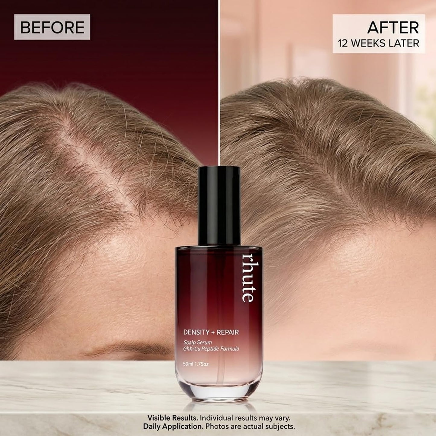 Rhute Hair Serum, Rhute Scalp Serum Daily Strengthening Treatment for Weak or Damaged Haireptide-Powered Formula for Thicker (2pcs)