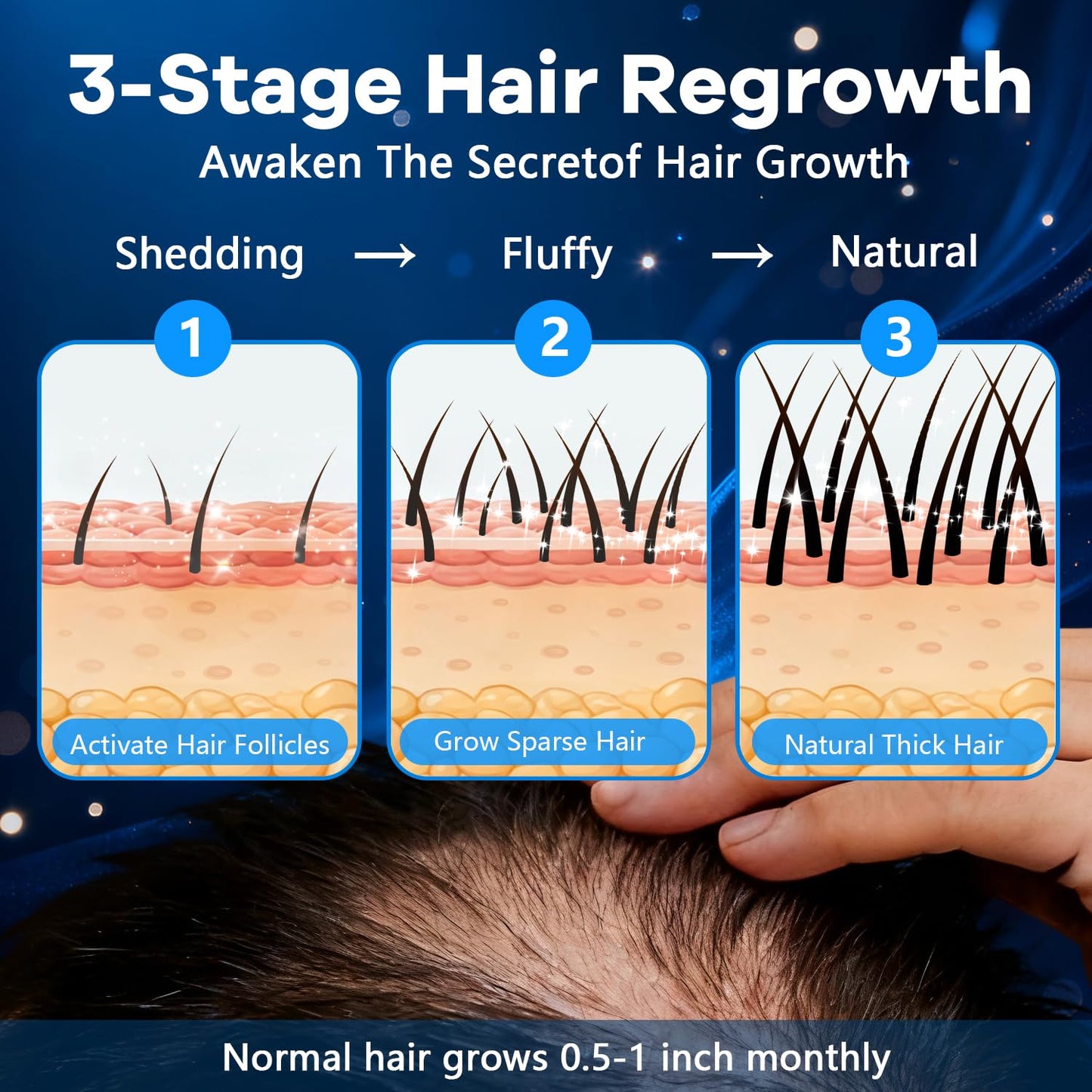 5% Topical Minoxidil Foam, Aerosol Minoxidil for Men, Infused with Biotin, Hair Growth Treatment, Supports Thicker and Fuller Hair & Beard Unscented (Minoxidil Foam, 8.44oz, 4 Months Supply)