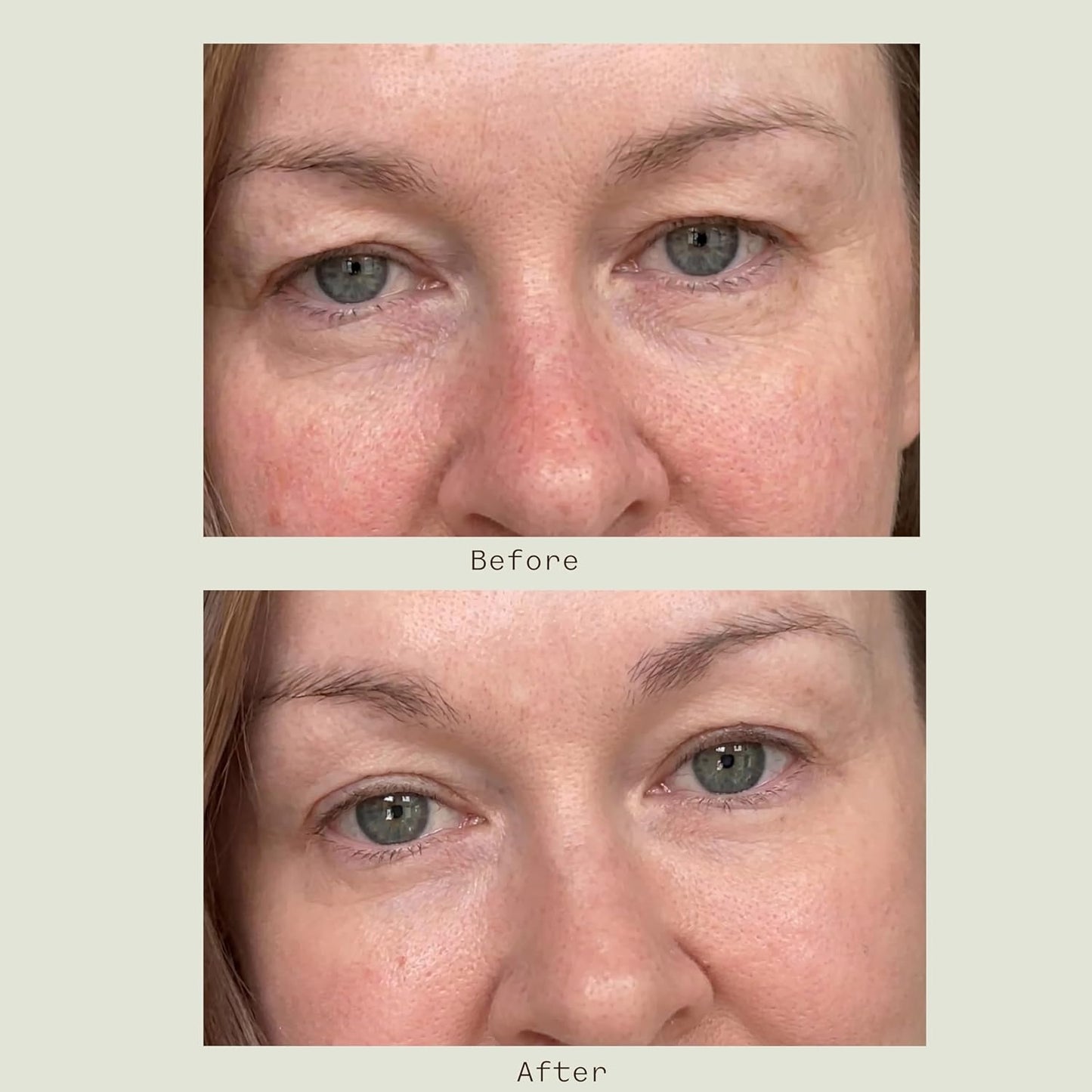 Under Eye Cream for Dark Circles - Caffeine & Peptides, Firming Formula for Puffiness & Fine Lines | 0.5 oz