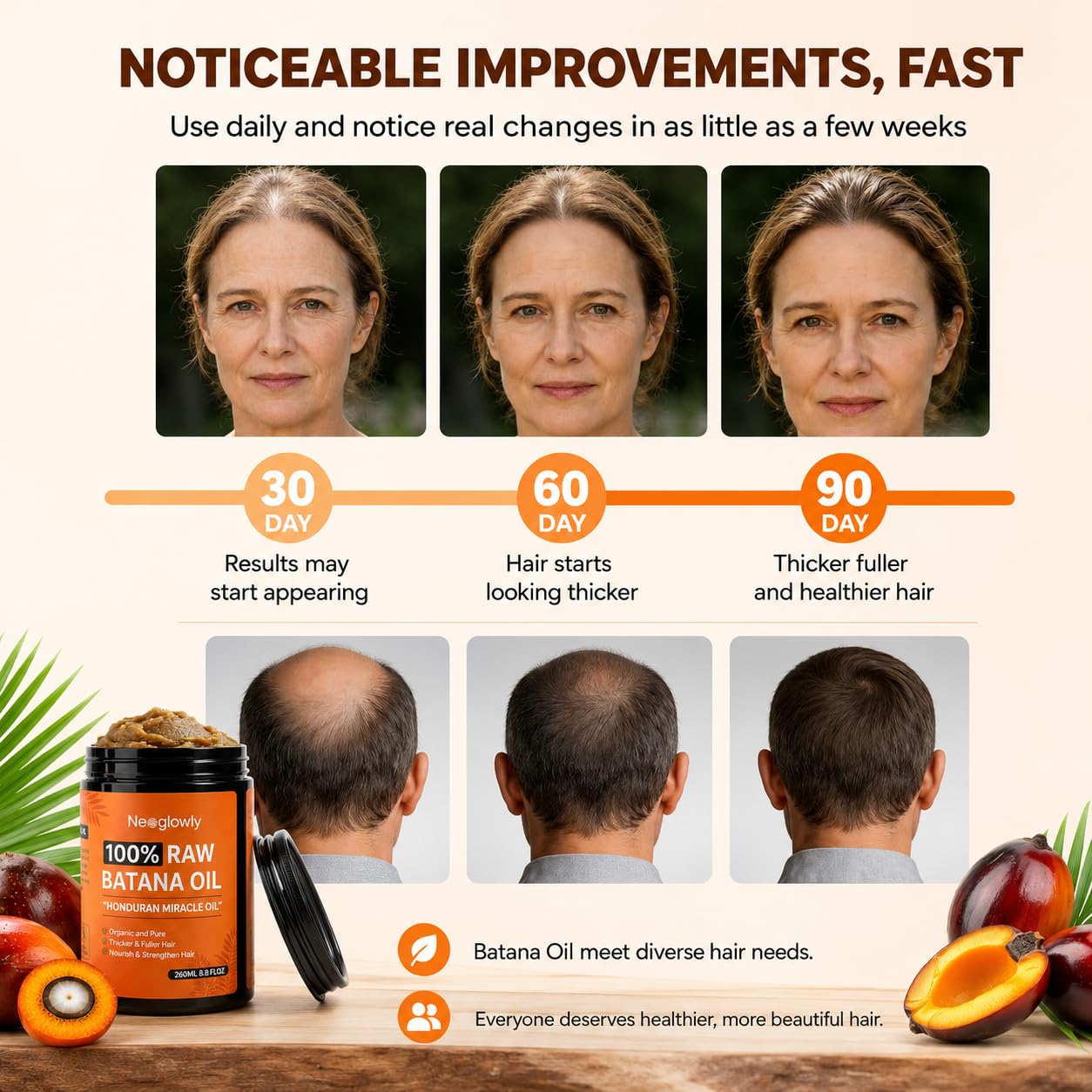 Batana Oil for Hair Growth 8.8oz, 100% Pure & Unrefined Batana Oil from Honduras, Cold Pressed Hair Treatment Oil for Thicker Fuller Stronger Hair, Deep Scalp Moisturizer for Men & Women