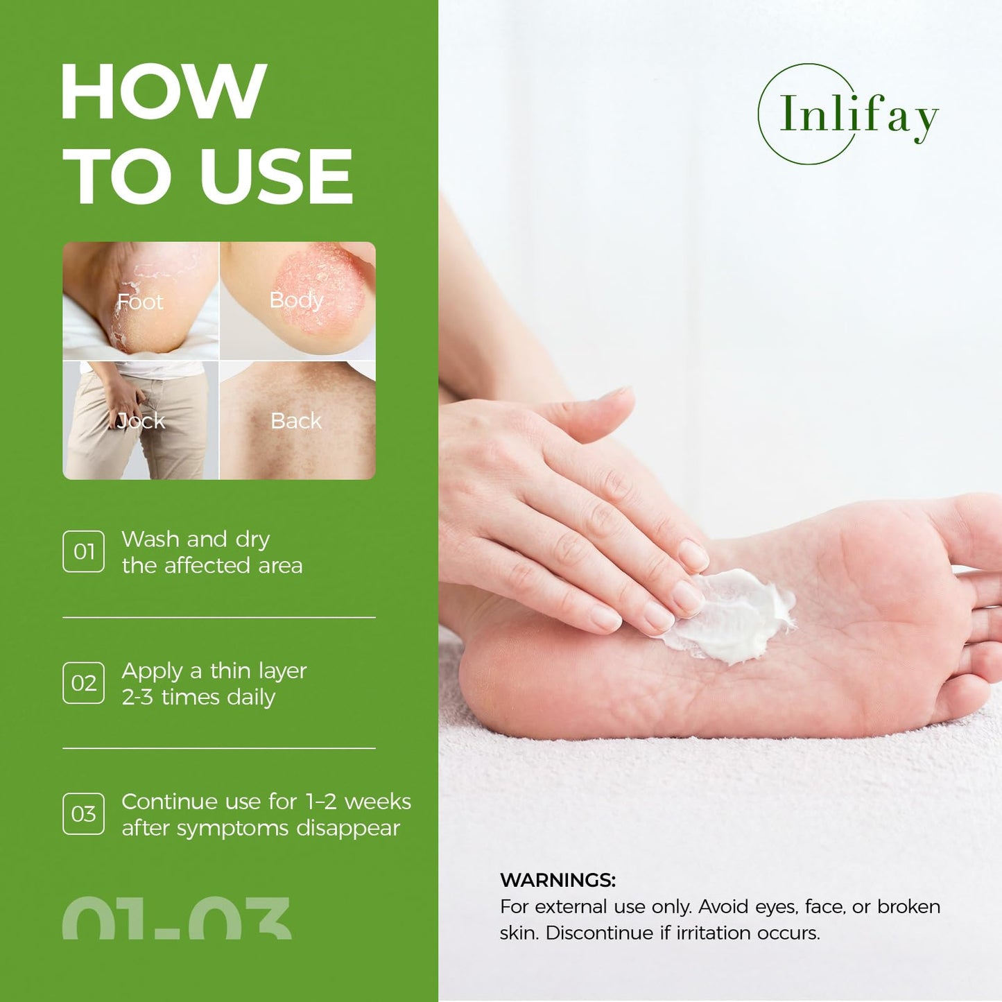 Inlifay 2% Miconazole Antifungal Cream: Helps relieve the itching, burning, cracking, and scaling associated with fungal infections such as athlete's foot,jock itch, and ringworm(3.52 OZ)