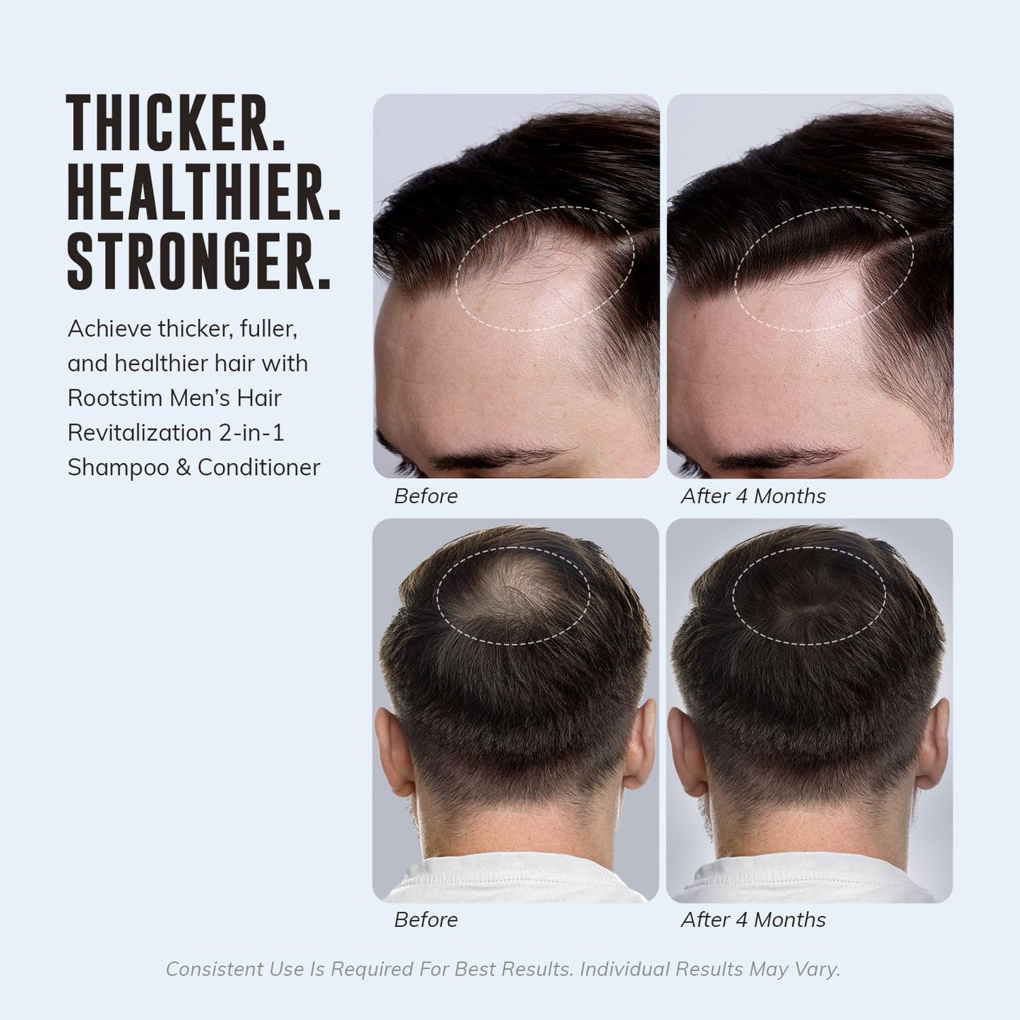 DHT Blocking Shampoo for Men - Hair Thickening & Anti Hair Loss Shampoo with Saw Palmetto, Biotin & Rosemary for Hair Growth - 2-in-1, Sulfate-Free, 10oz